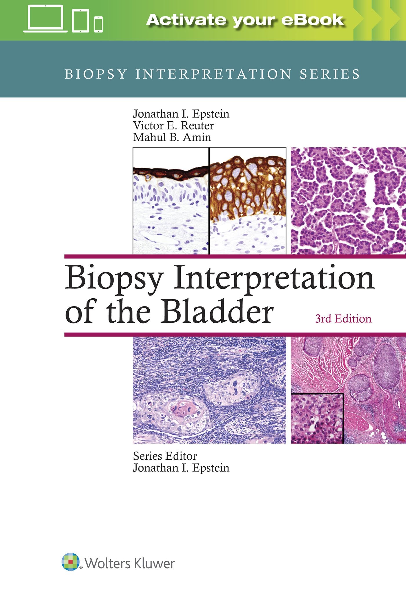 Biopsy Interpretation of the Bladder (Biopsy Interpretation Series)