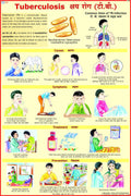 Tuberculosis Chart