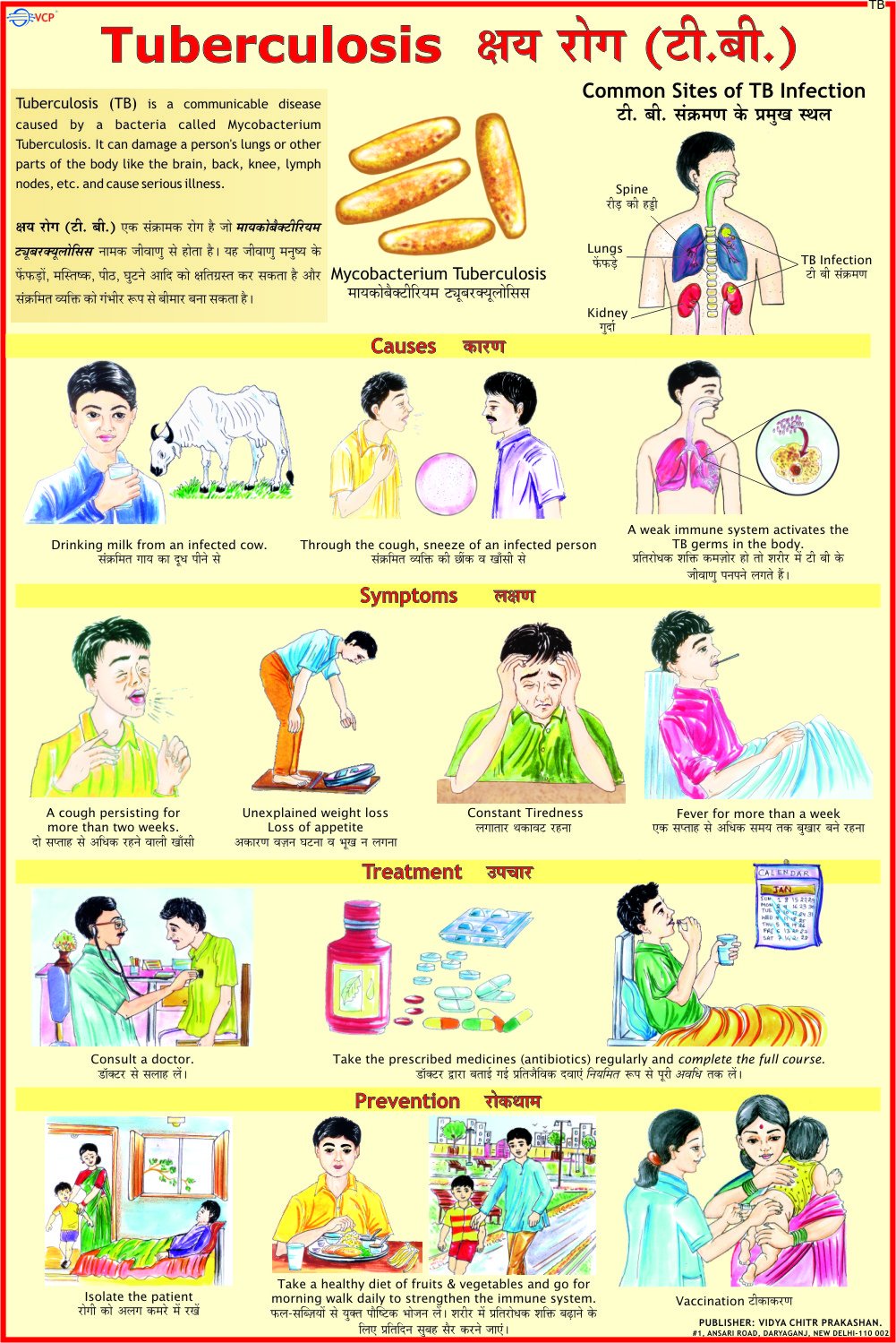 Tuberculosis Chart