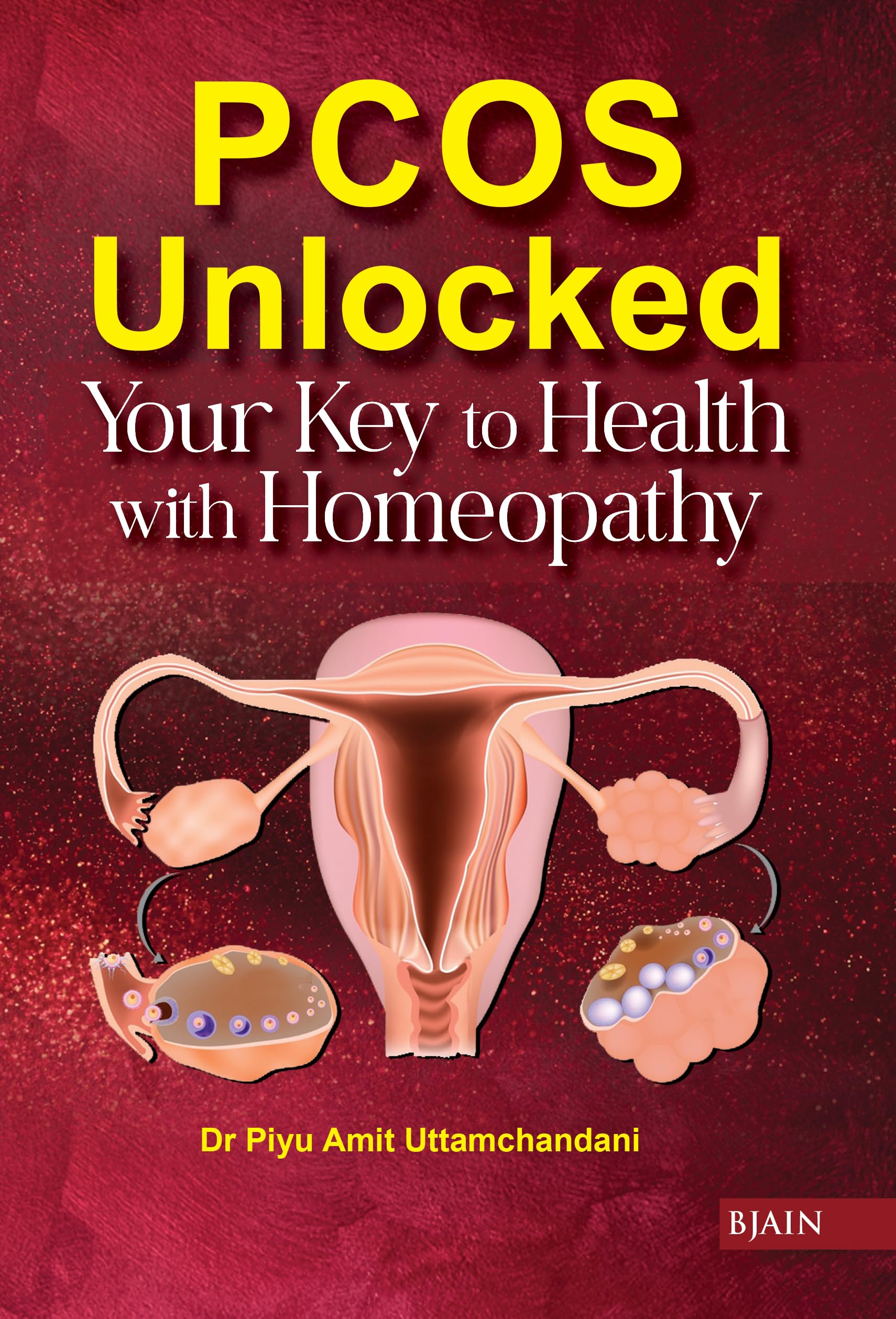 PCOS Unlocked Your Key to Health with Homeopathy