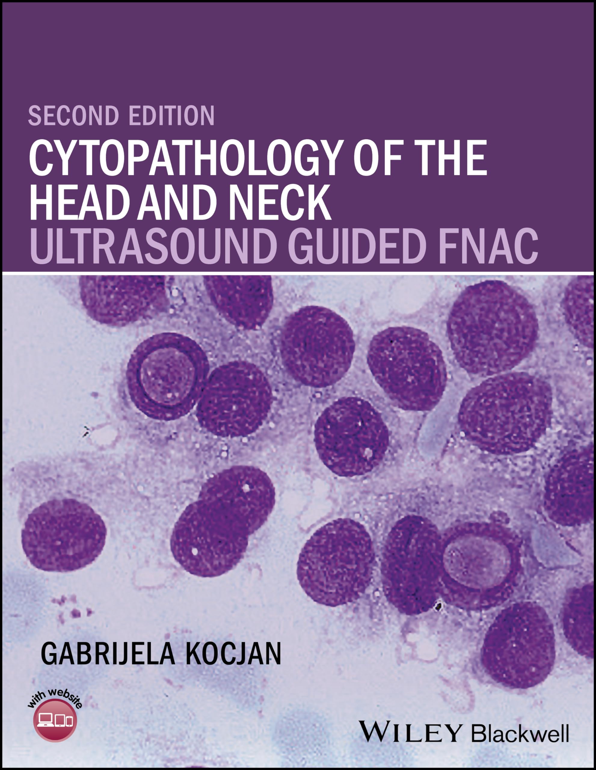 Cytopathology of the Head and Neck: Ultrasound Guided FNAC
