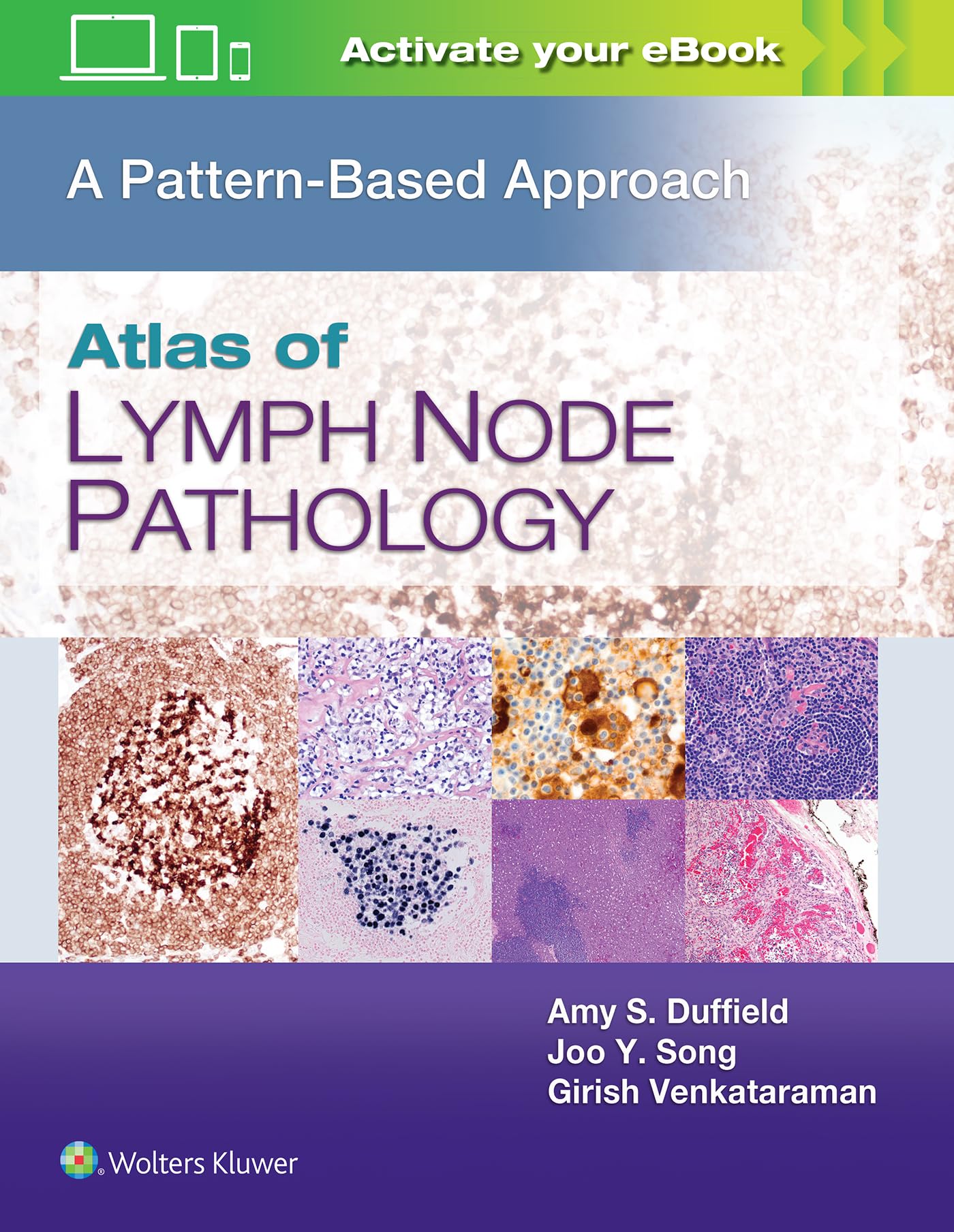Atlas of Lymph Node Pathology: A Pattern Based Approach
