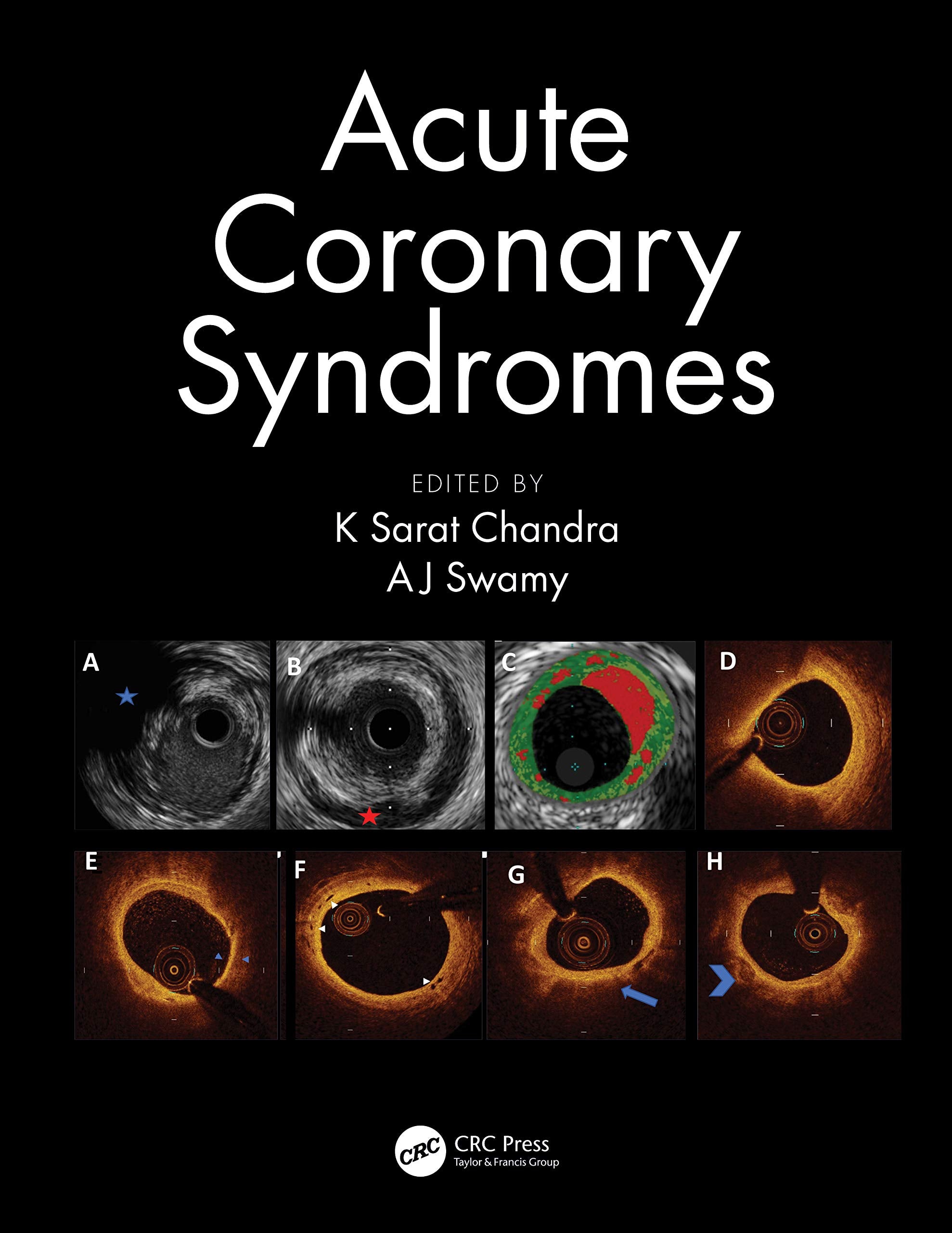 Acute Coronary Syndromes (Pb 2020)