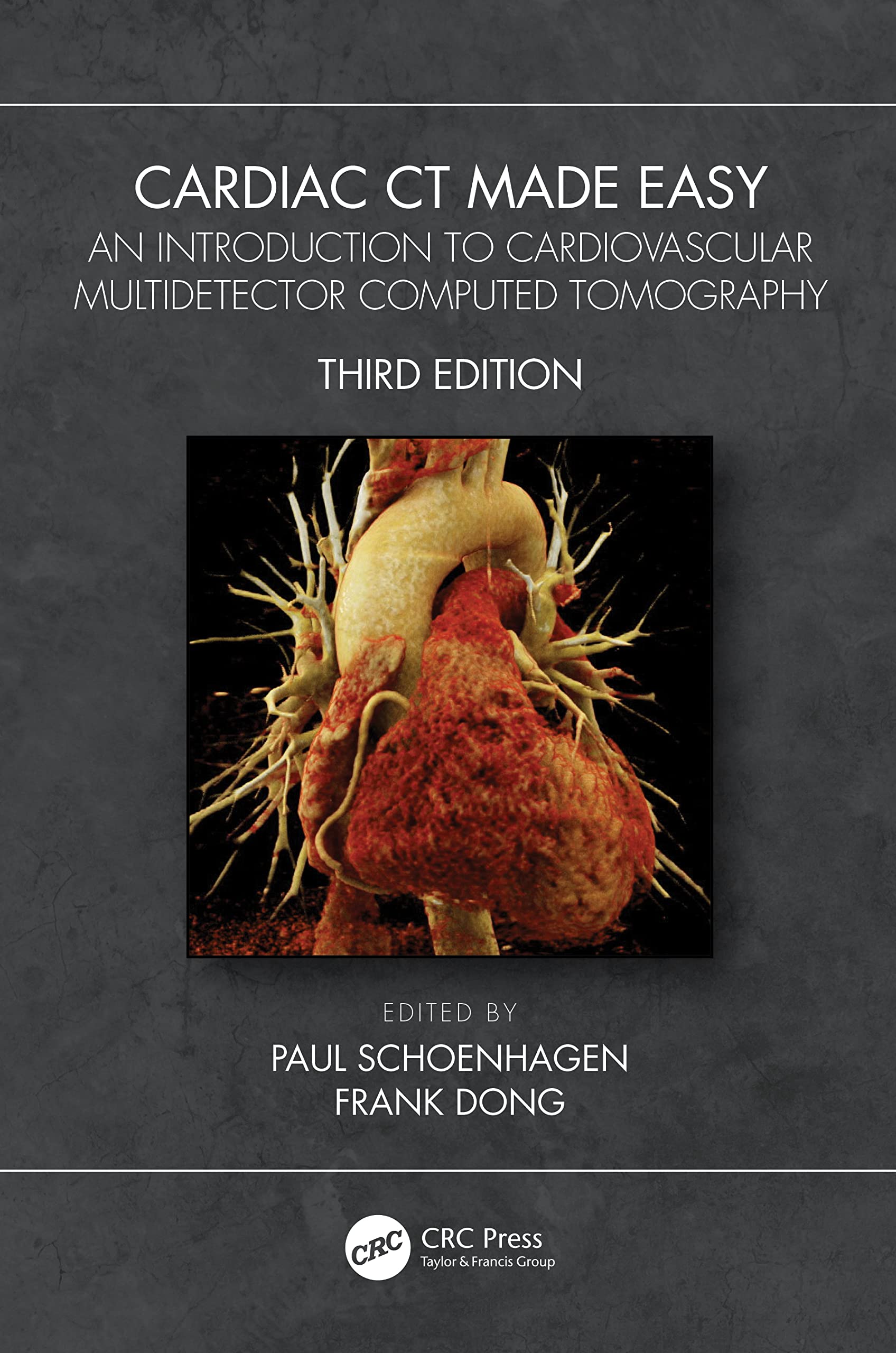 CARDIAC CT MADE EASY