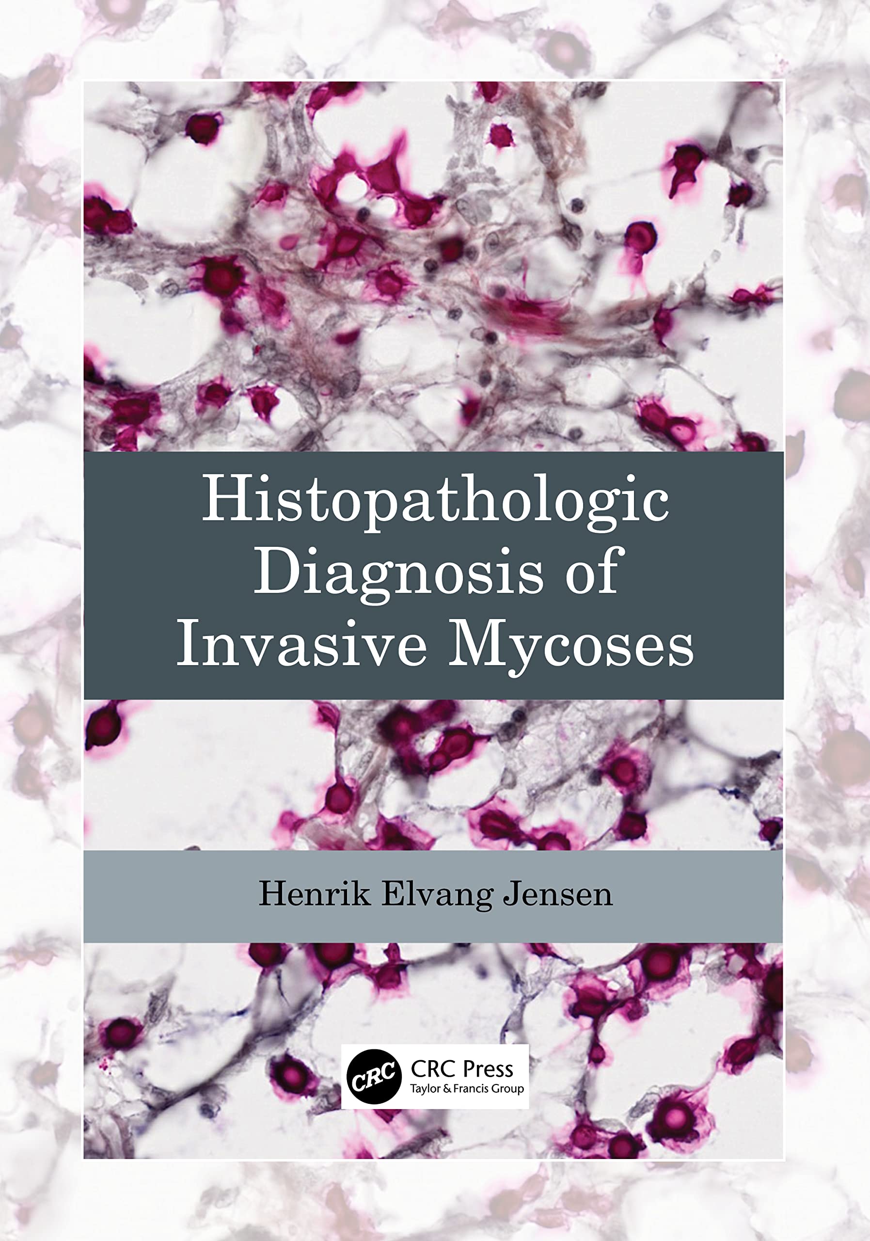 HISTOPATHOLOGIC DIAGNOSIS OF INVASIVE MYCOSES (PB 2023)