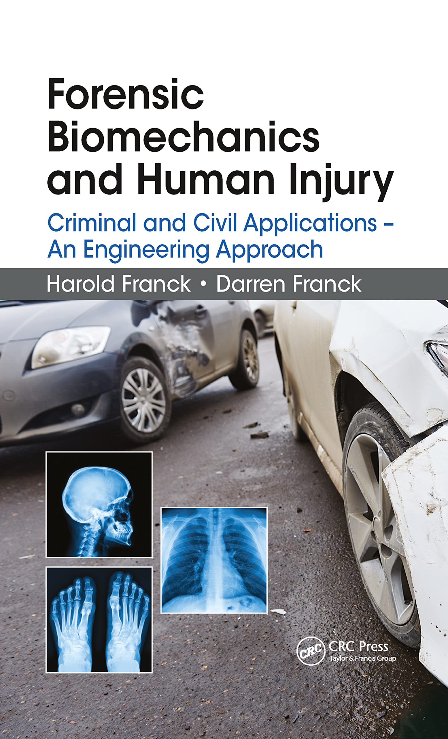 FORENSIC BIOMECHANICS AND HUMAN INJURY CRIMINAL AND CIVIL APPLICATIONS AN ENGINEERING APPROACH (PB 2020)