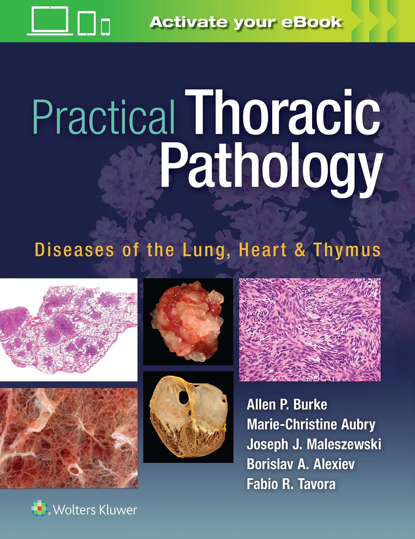 Practical Thoracic Pathology Diseases Of The Lung Heart And Thymus (Hb 2017)
