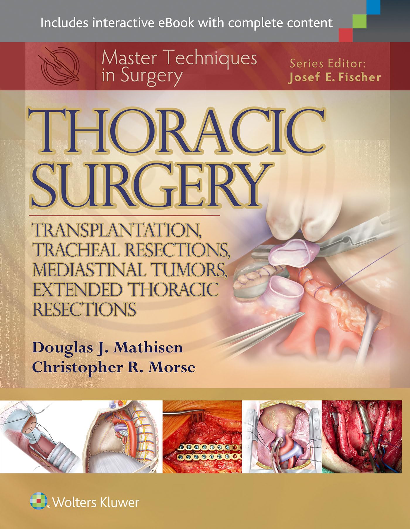 Master Techniques In Surgery Thoracic Surgery Transplantation Tracheal Resections Mediastinal Tumors Extended Thoracic Resection