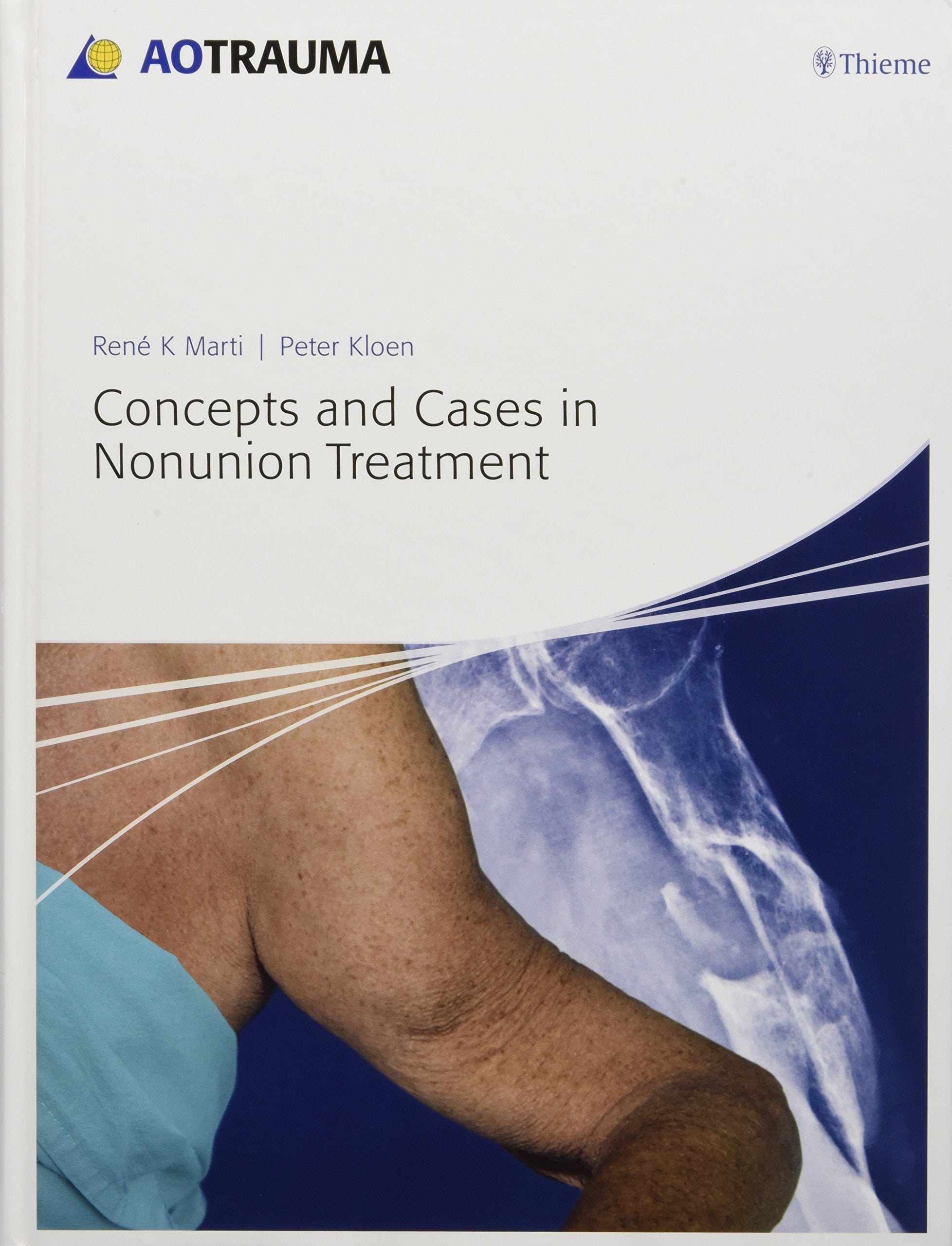 Concepts and Cases in Nonunion Treatment (AO Trauma Handbooks)