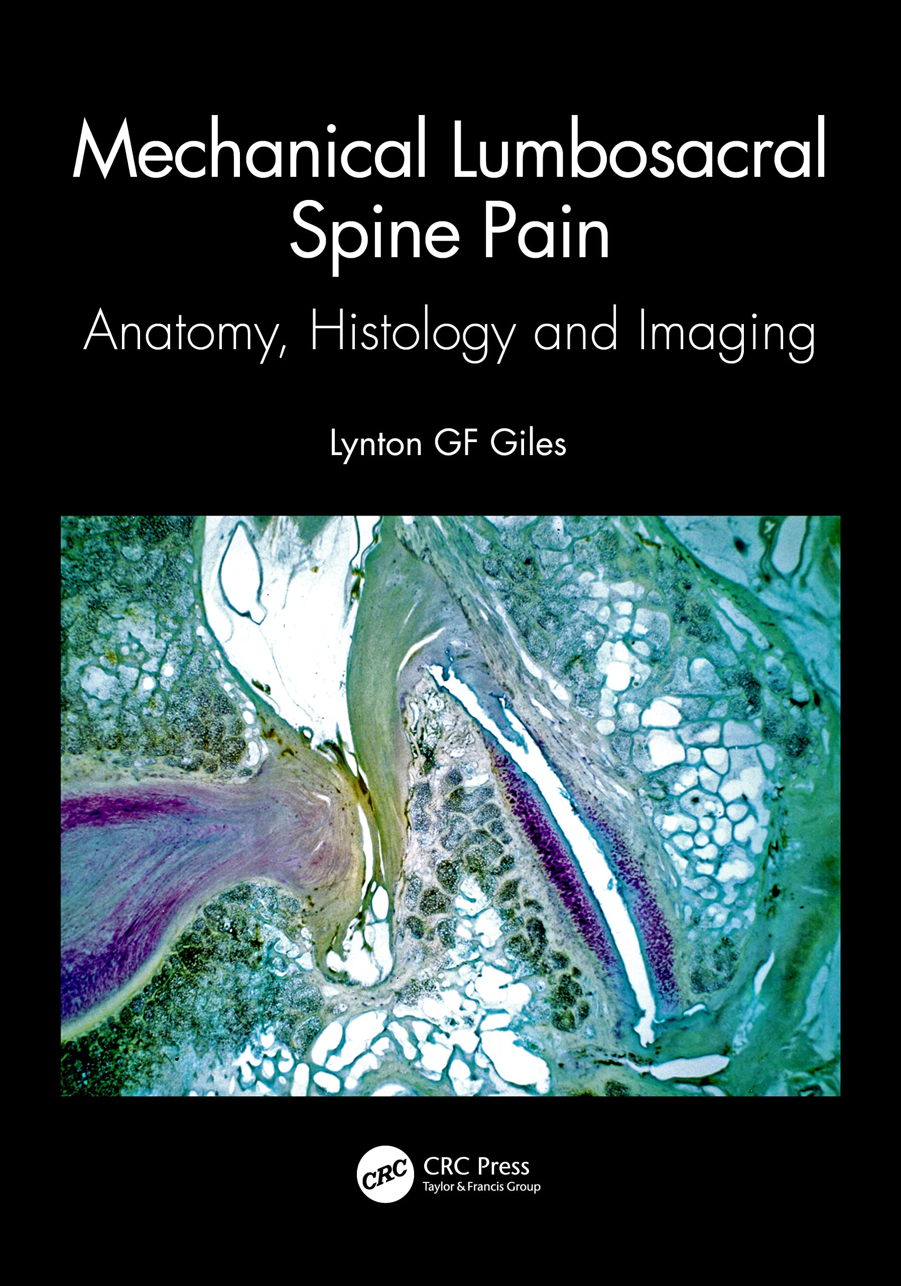 Mechanical Lumbosacral Spine Pain Anatomy Histology And Imaging (Pb 2023)
