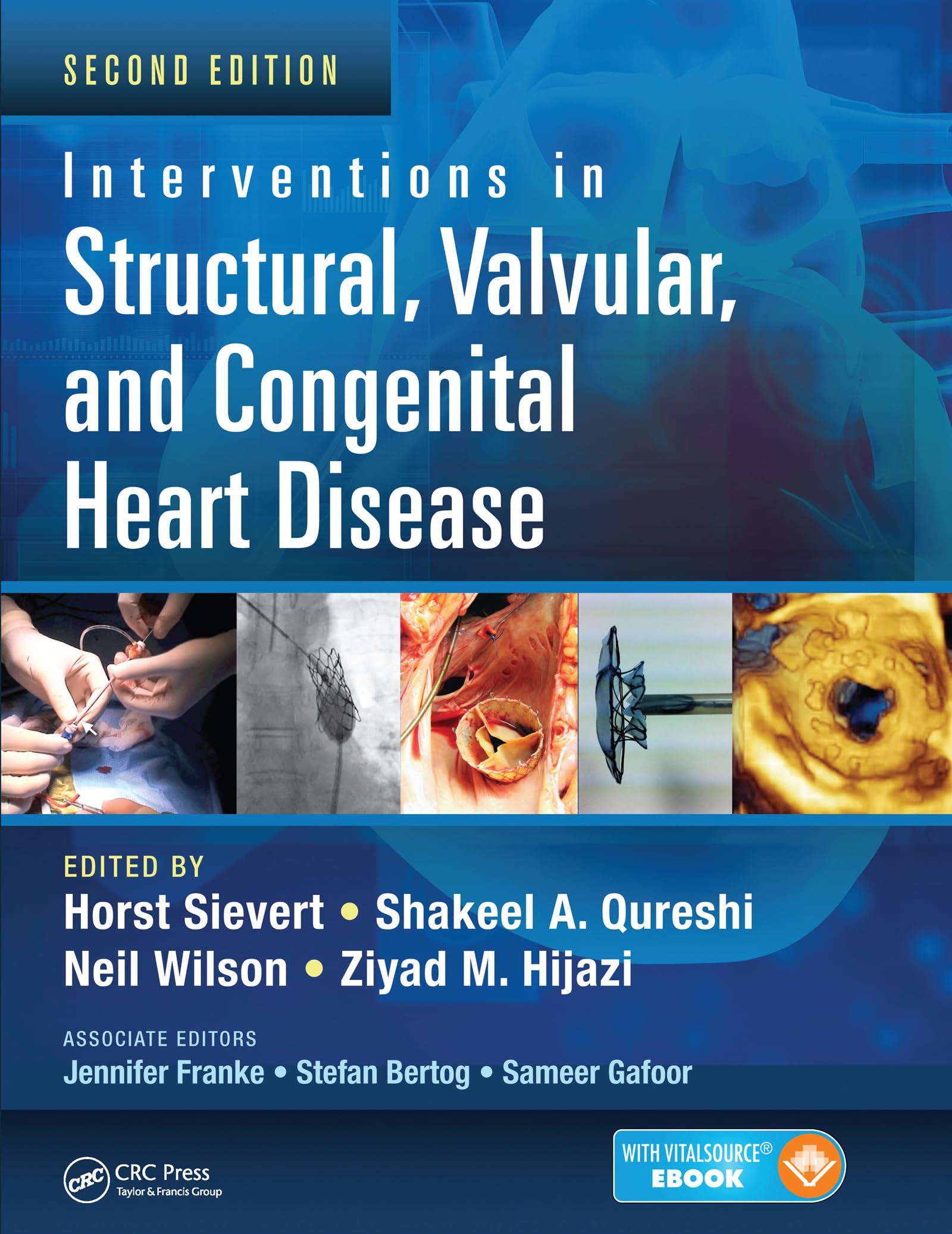 Interventions in Structural Valvular and Congenital Heart Disease