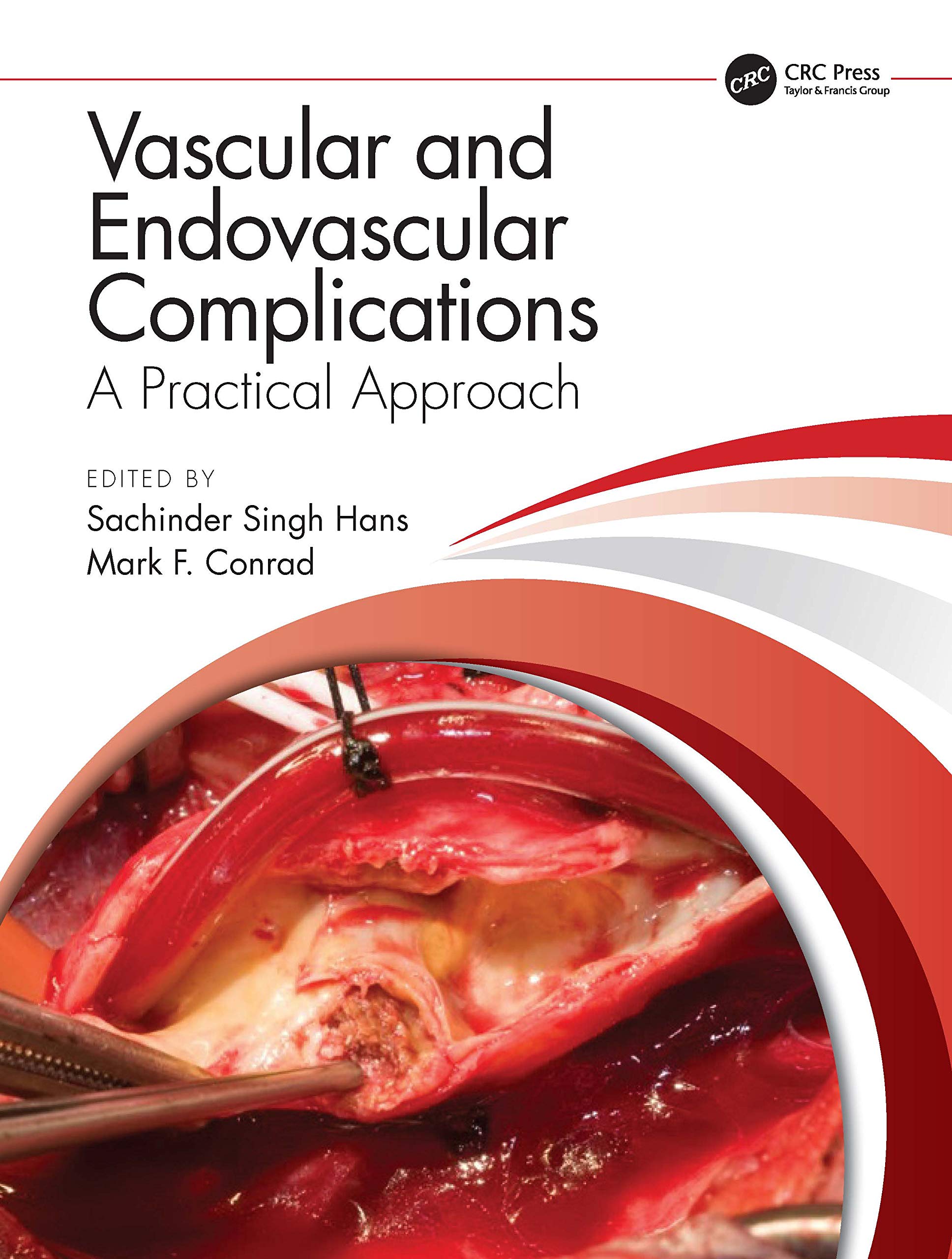 Vascular And Endovascular Complications: A Practical Approach