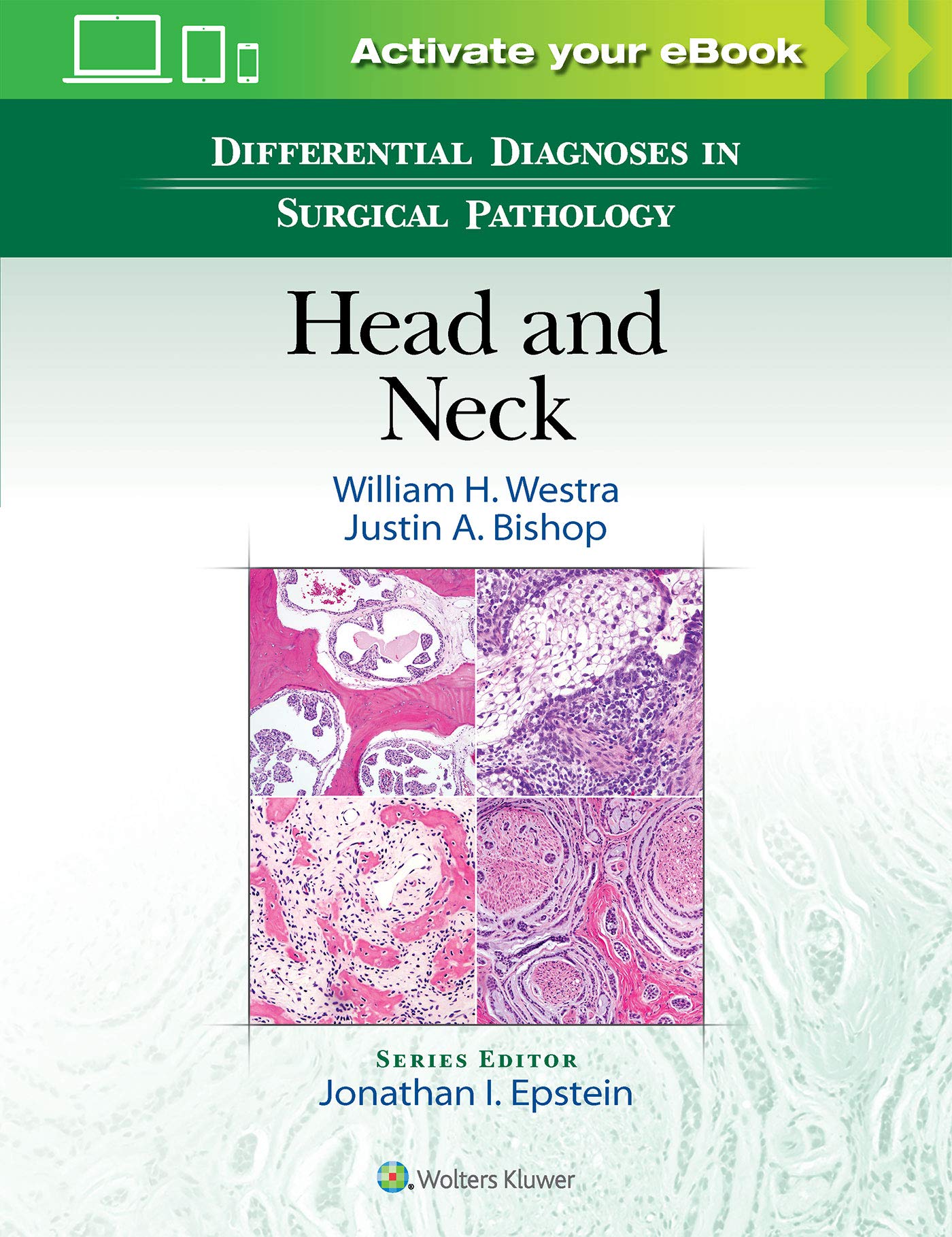 Differential Diagnoses In Surgical Pathology Head And Neck (Hb 2017)