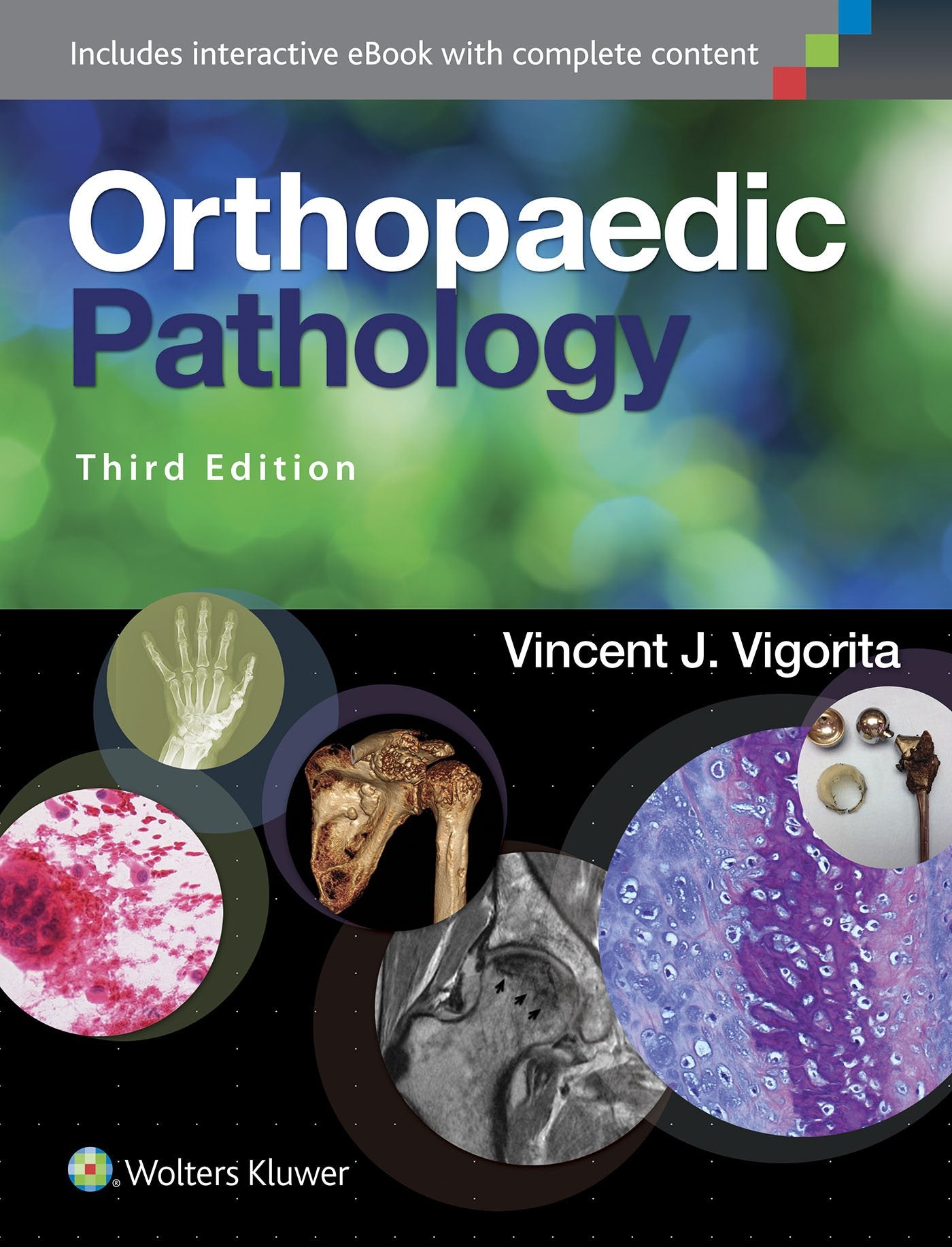 ORTHOPAEDIC PATHOLOGY 3ED (HB 2016)