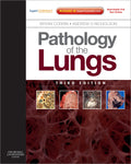 Pathology of the Lungs: Expert Consult: Online and Print