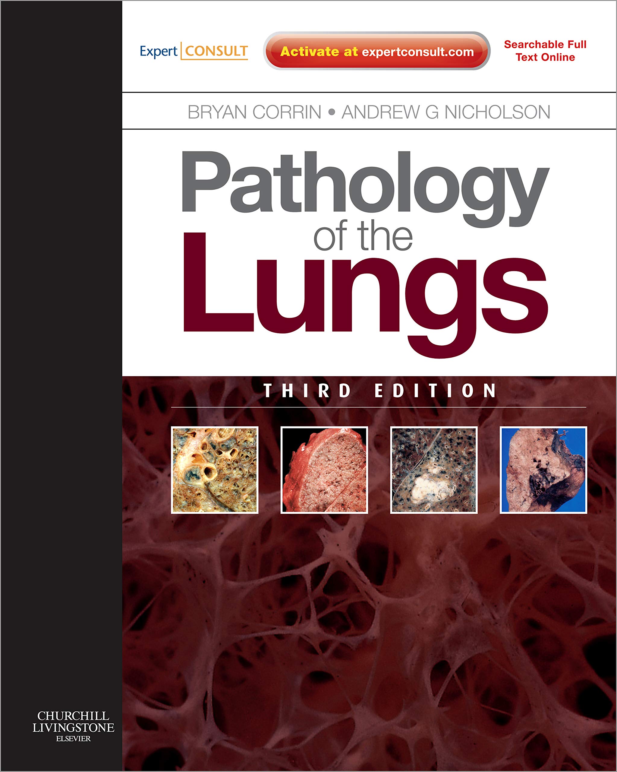 Pathology of the Lungs: Expert Consult: Online and Print