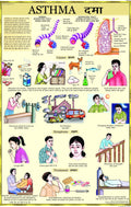 Asthma Chart