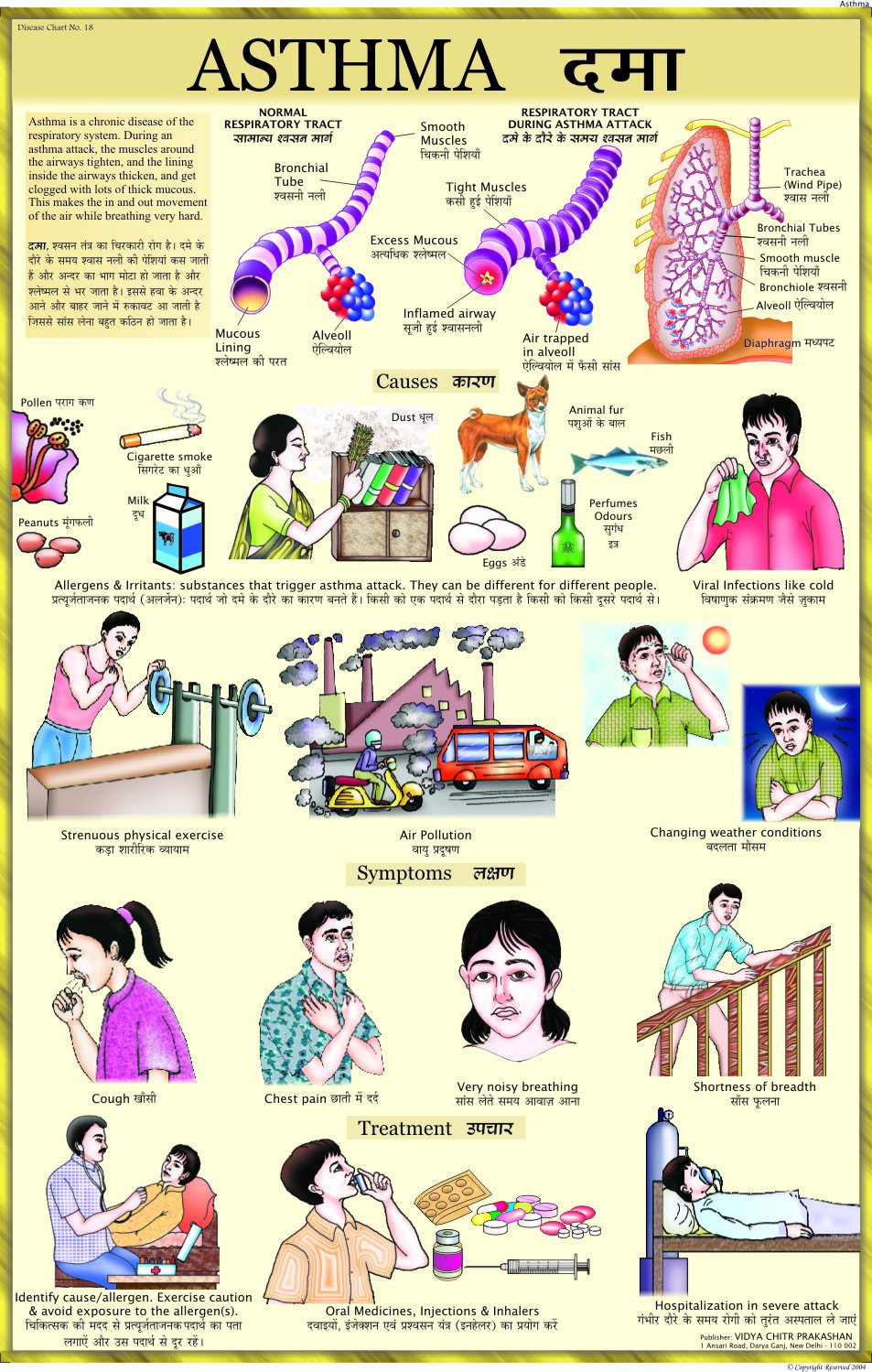 Asthma Chart