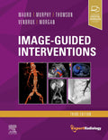 ImageGuided Interventions: Expert Radiology Series