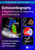 Echocardiography A Practical Guide For Reporting And Interpretation 4Ed (Pb 2024)