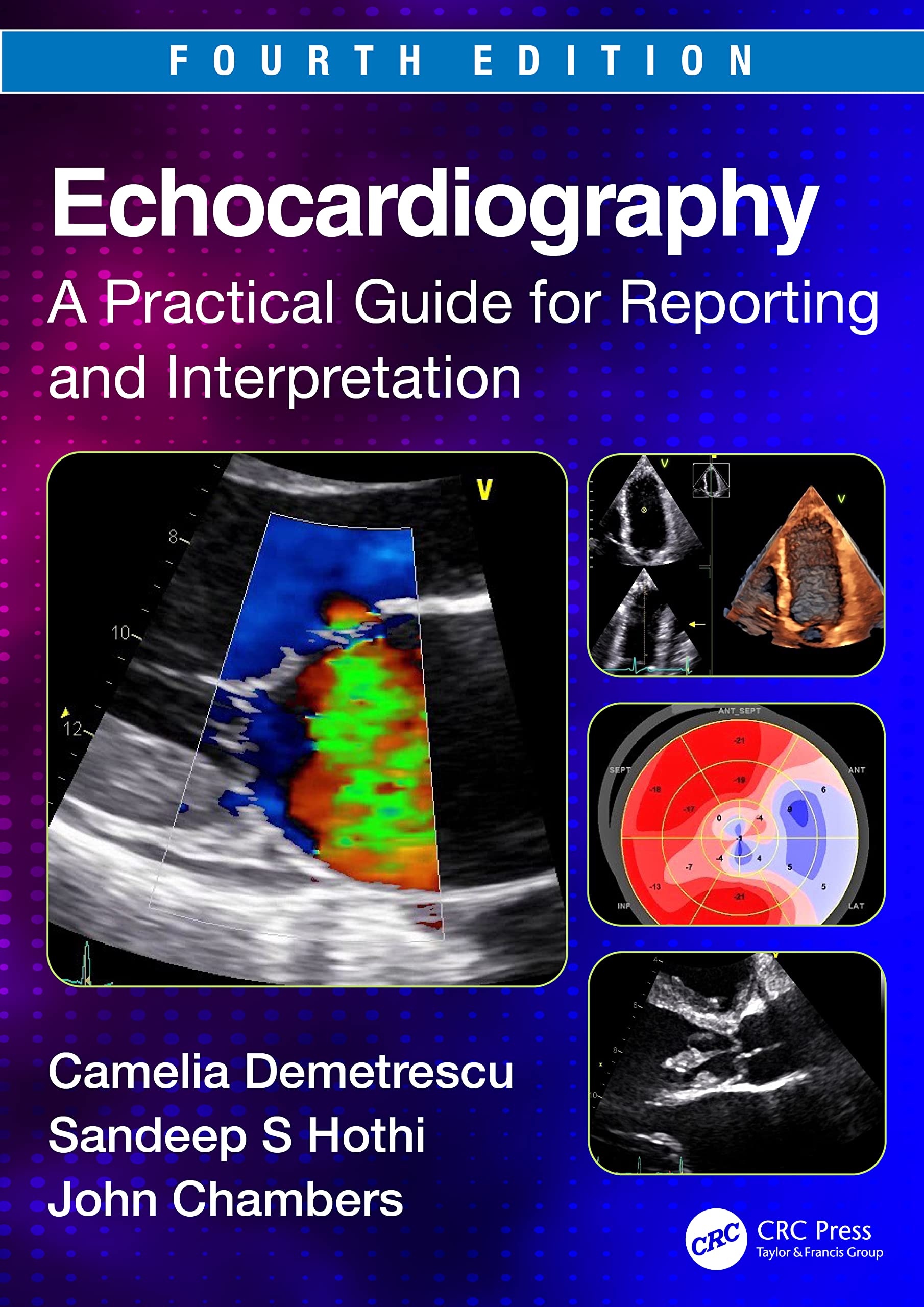 Echocardiography A Practical Guide For Reporting And Interpretation 4Ed (Pb 2024)