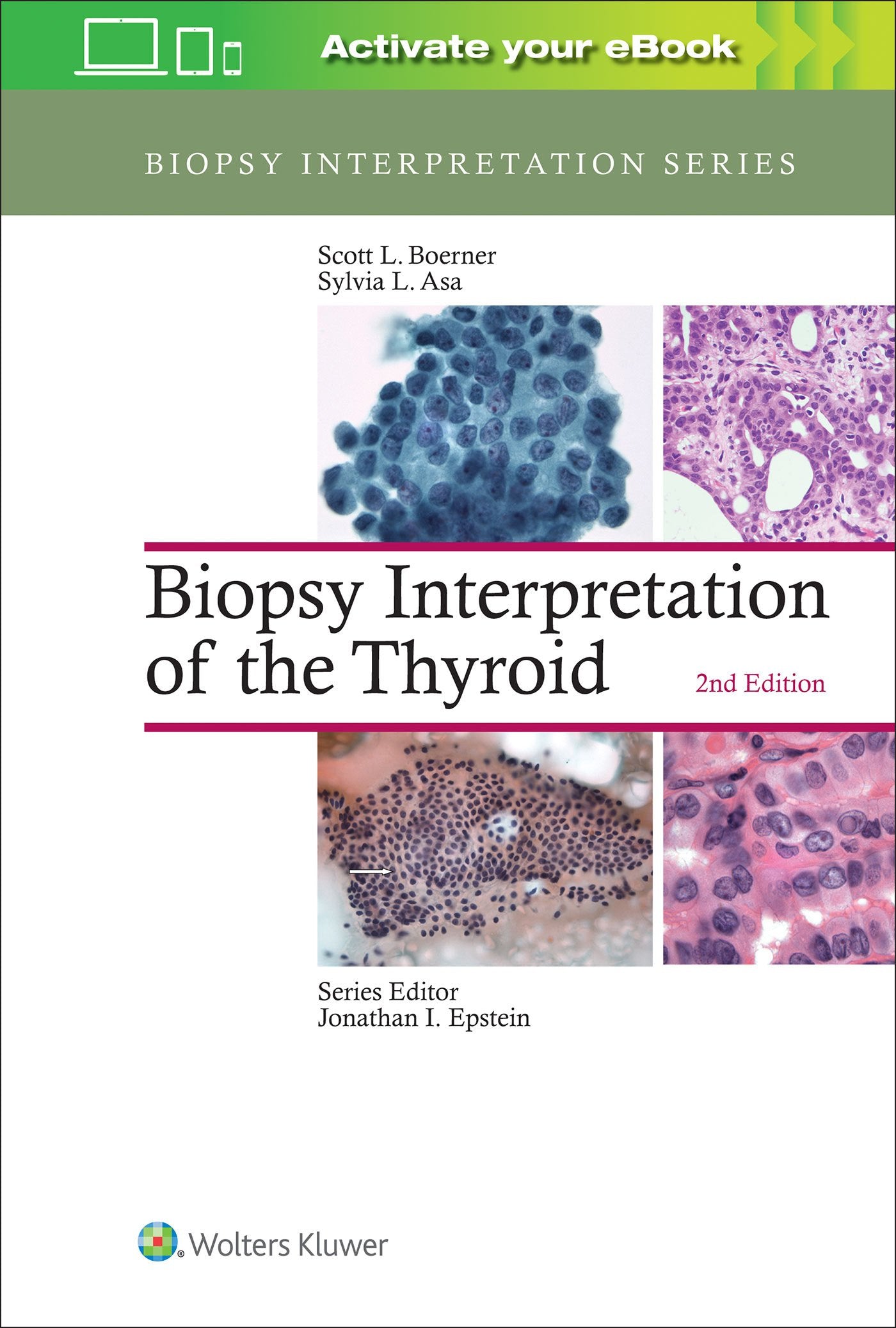 Biopsy Interpretation Of The Thyroid 2Ed (Hb 2017) (Biopsy Interpretation Series)