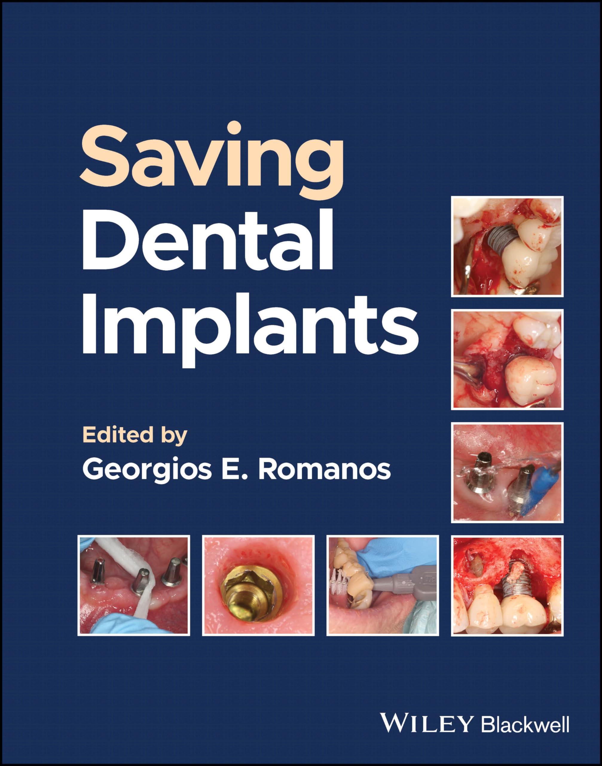 SAVING DENTAL IMPLANTS (HB 2024)