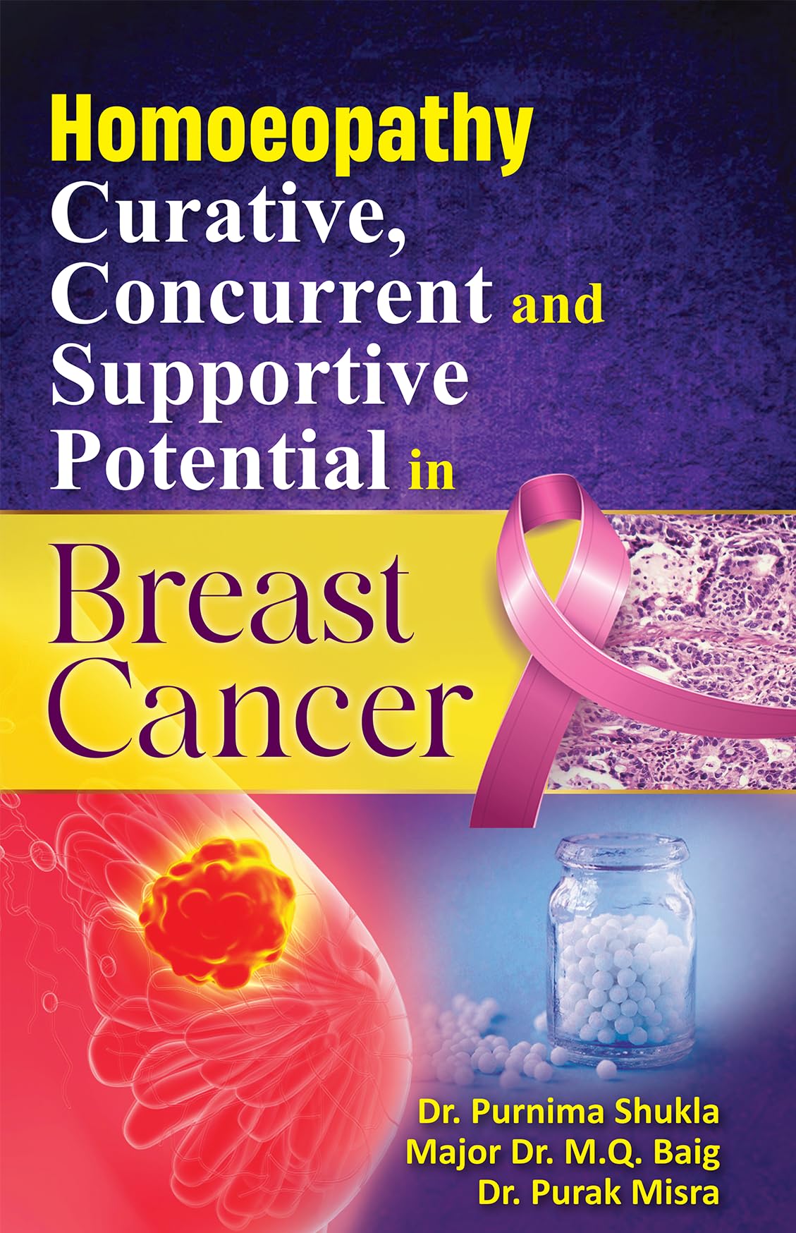Homoeopathy Curative, Concurrent & Supportive Potential in Breast Cancer