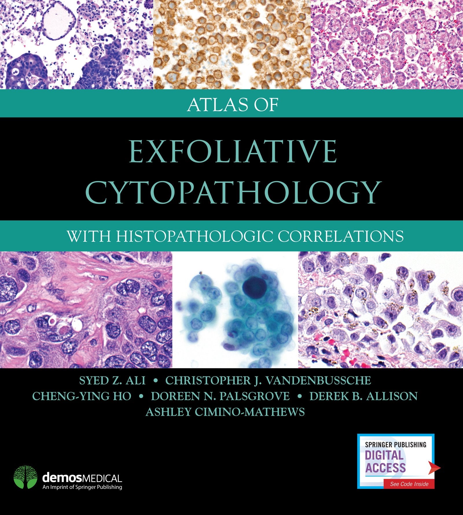 Atlas Of Exfoliative Cytopathology With Histopathologic Correlations (Hb 2018)