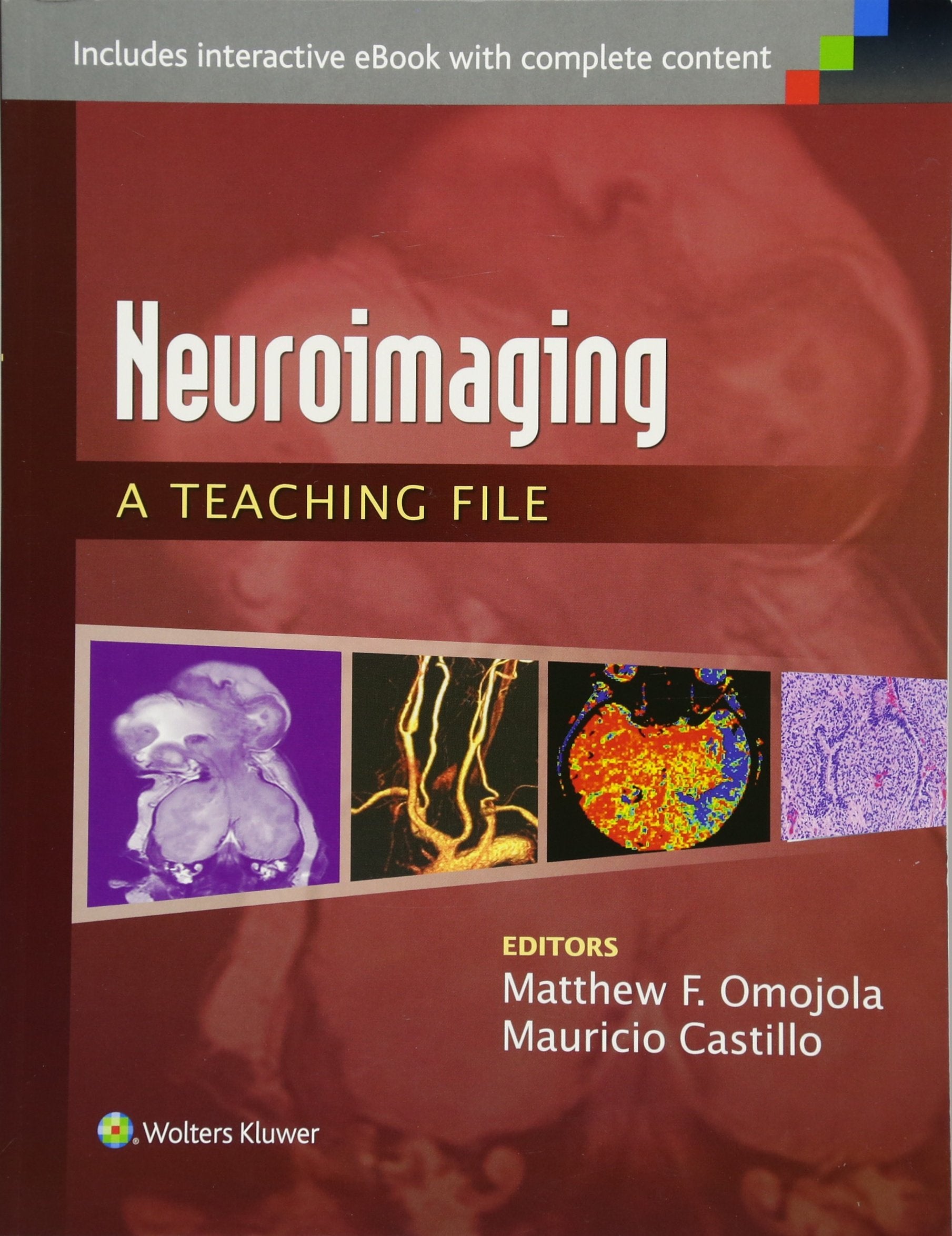 Neuroimaging A Teaching File (Pb 2015) (Lww Teaching File Series)