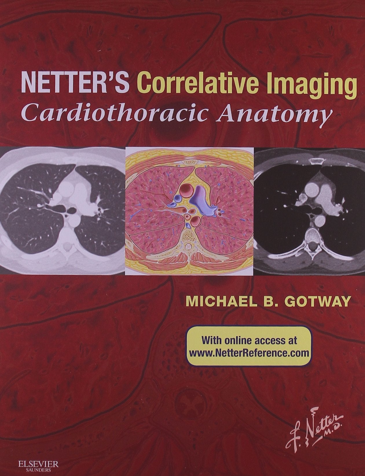 Netters Correlative Imaging: Cardiothoracic Anatomy: with Online Access (Netter Clinical Science)