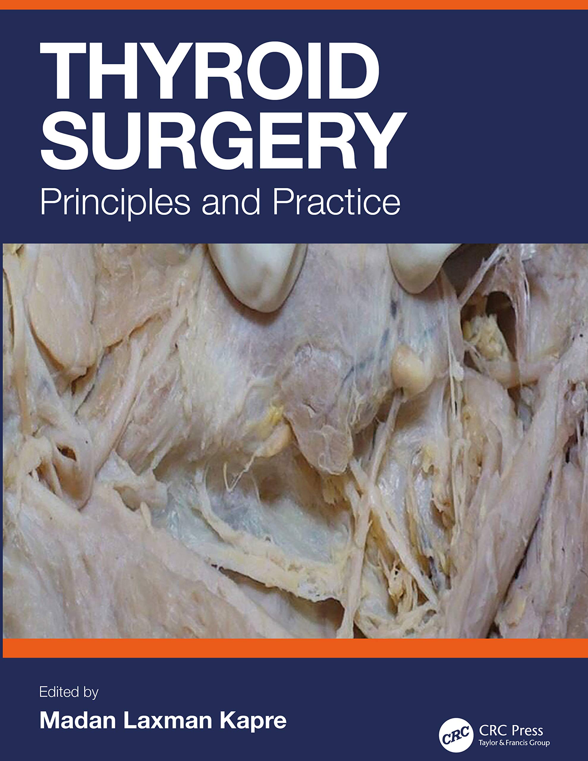 Thyroid Surgery Principles And Practice (Hb 2020)