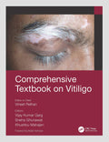 Comprehensive Textbook On Vitiligo (Pb 2022)