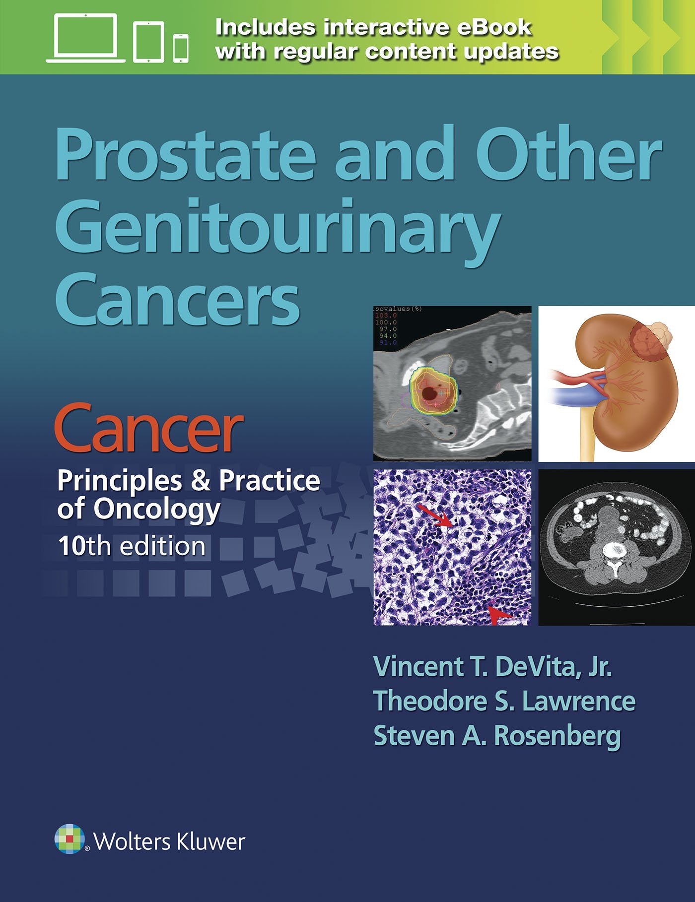 PROSTATE AND OTHER GENITOURINARY CANCERS 10ED (PB 2016): From Cancer: Principles & Practice of Oncology, 10th edition