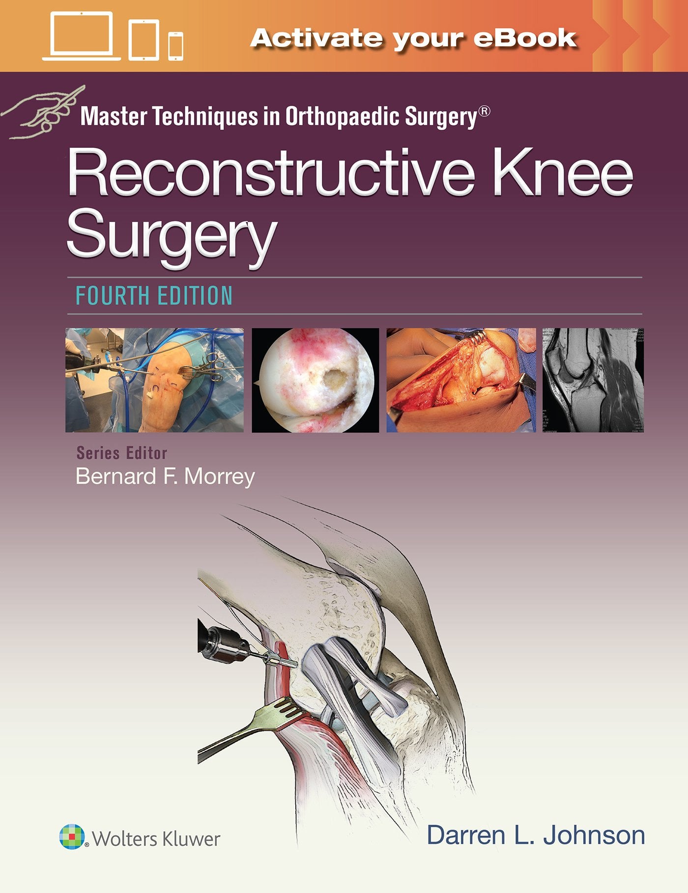 MASTER TECHNIQUES IN ORTHOPACEDIC SURGERY RECONSTRUCTIVE KNEE SURGERY 4ED (HB 2017)