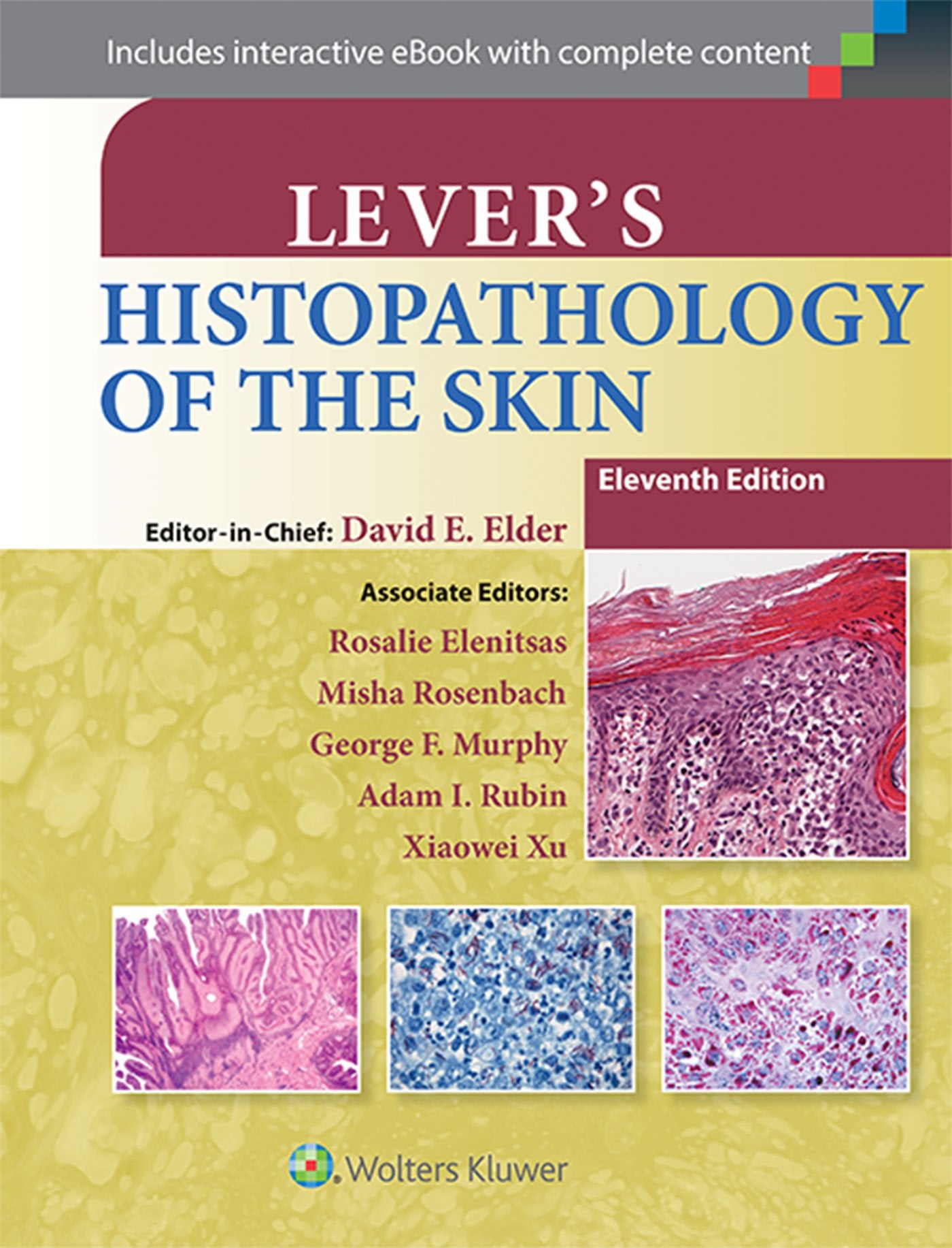 Levers Histopathology of the Skin