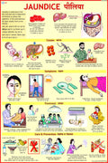 Jaundice Chart