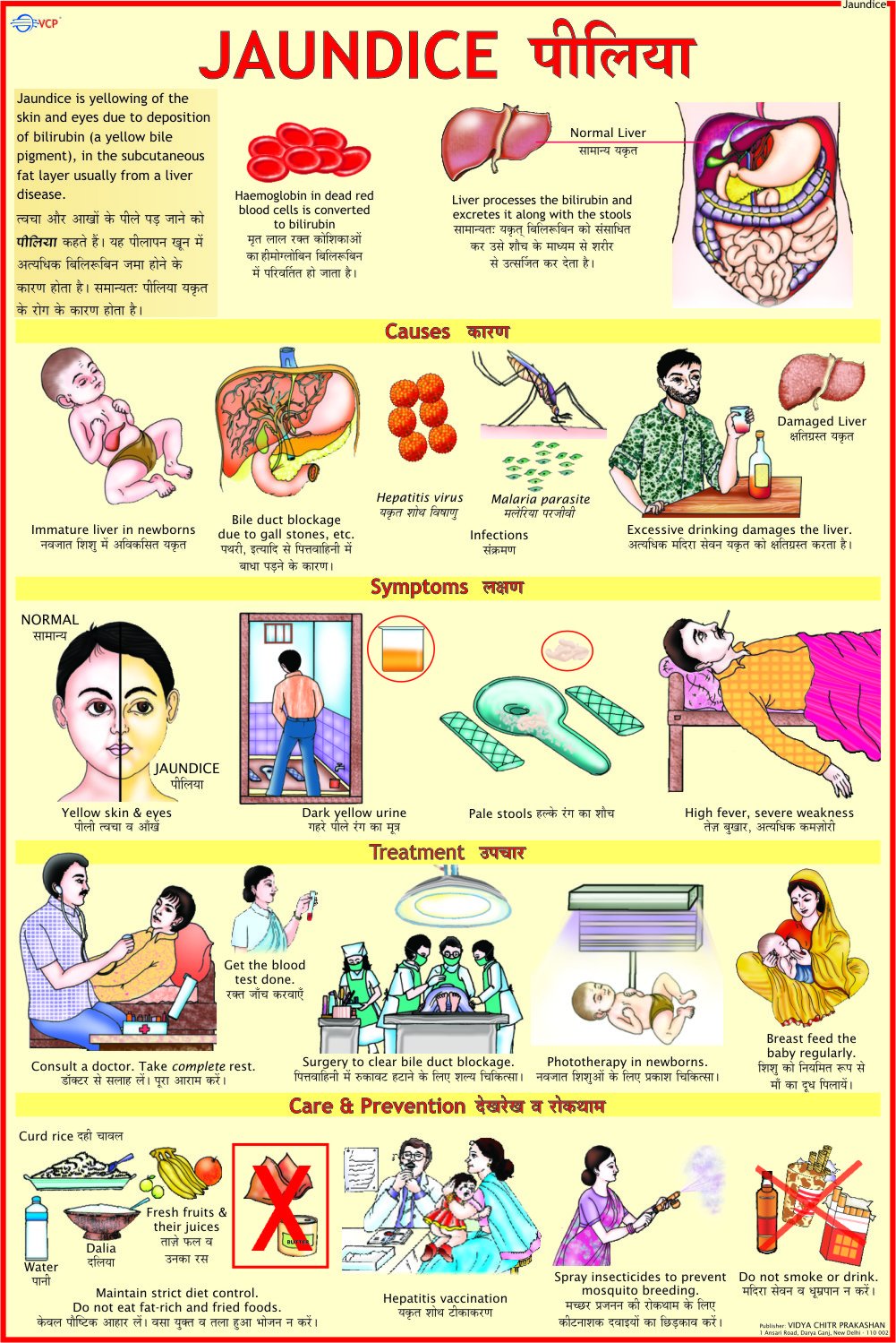 Jaundice Chart