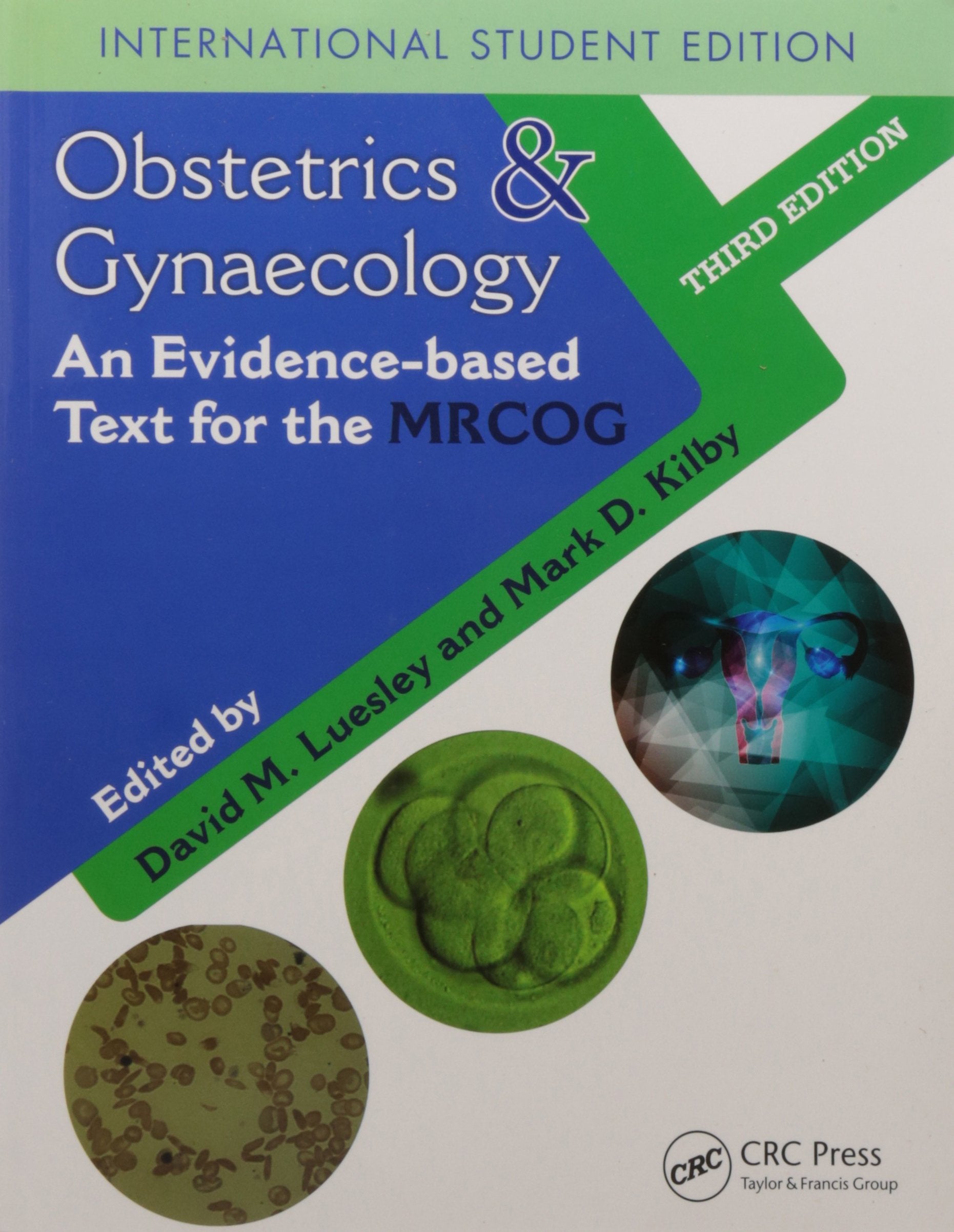 Obstetrics And Gynaecology: An EvidenceBased Text For Mrcog