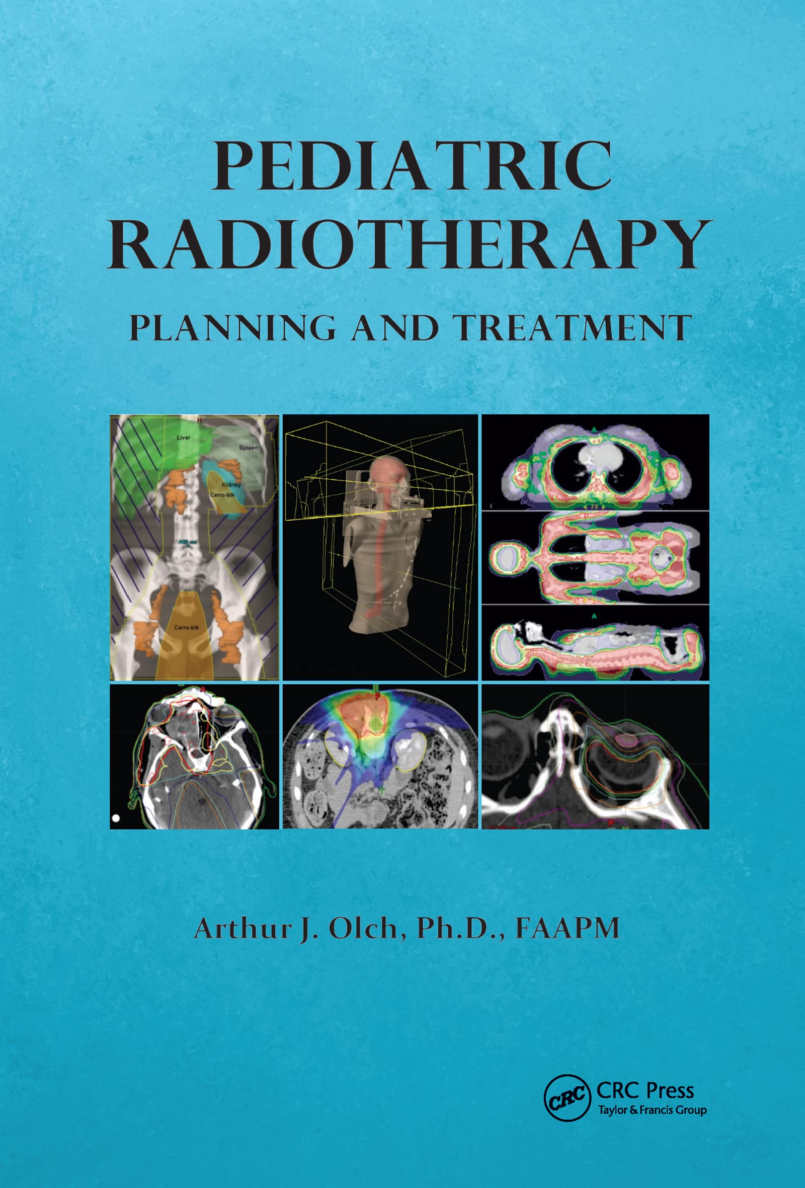 Pediatric Radiotherapy Planning and Treatment
