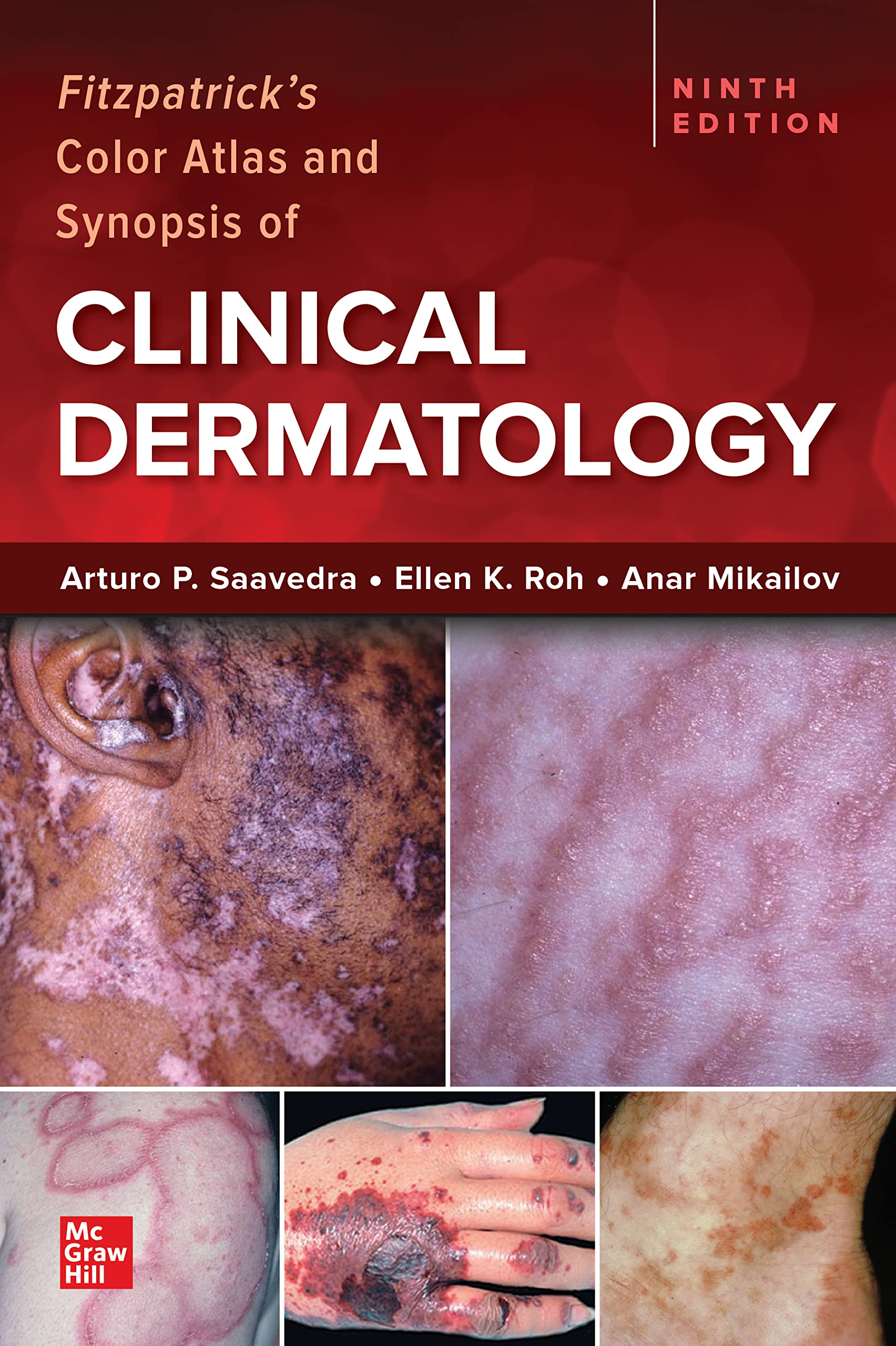 FITZPATRICKS COLOR ATLAS & SYNOPSIS OF CLINICAL DERMATOLOGY (IE)