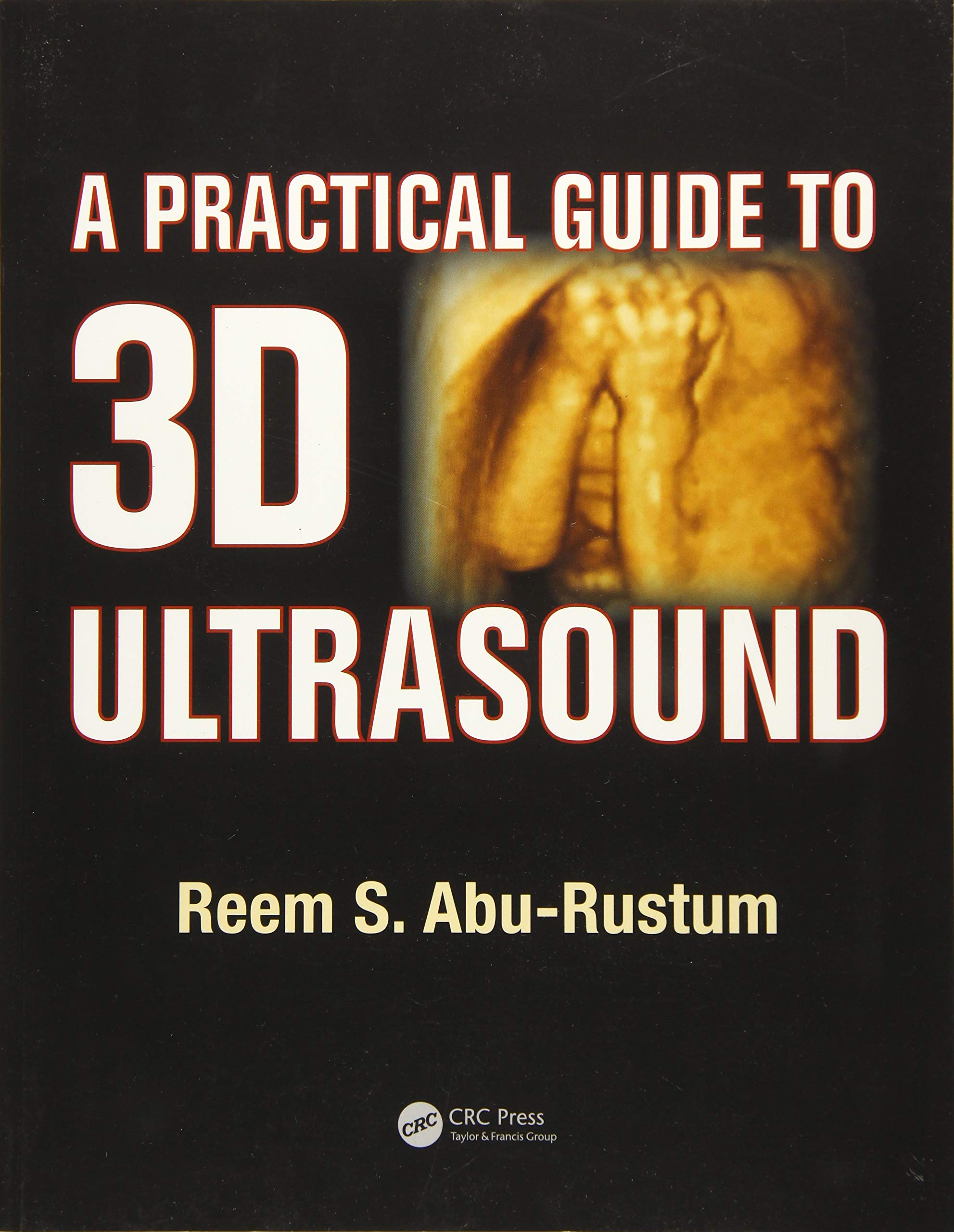 A Practical Guide To 3D Ultrasound (Pb 2015)