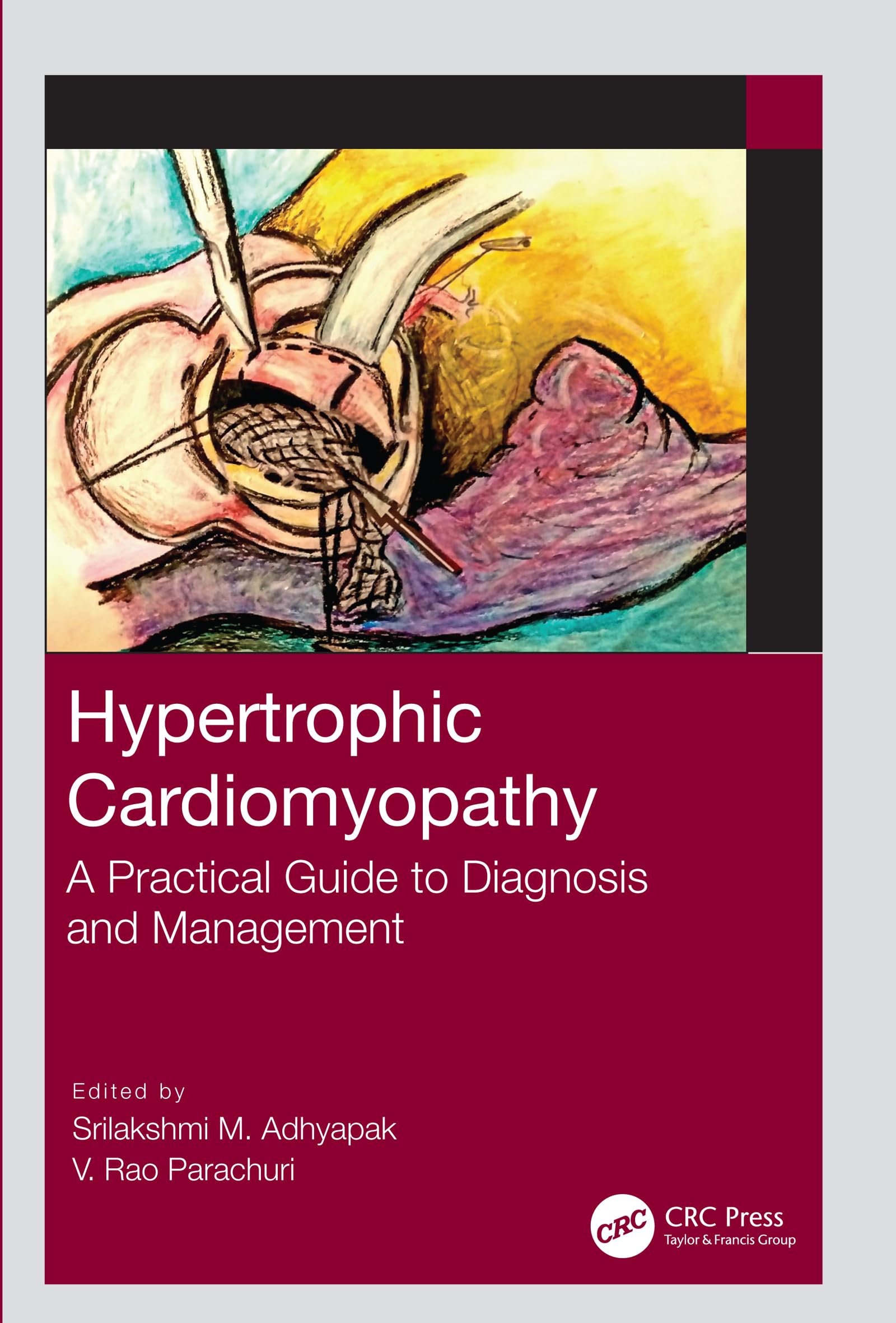 Hypertrophic Cardiomyopathy A Practical Guide To Diagnosis And Management (Pb 2021)