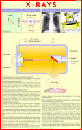 XRays Chart | Laminated | 55 x 90 cm | Physics Chart | Science Chart