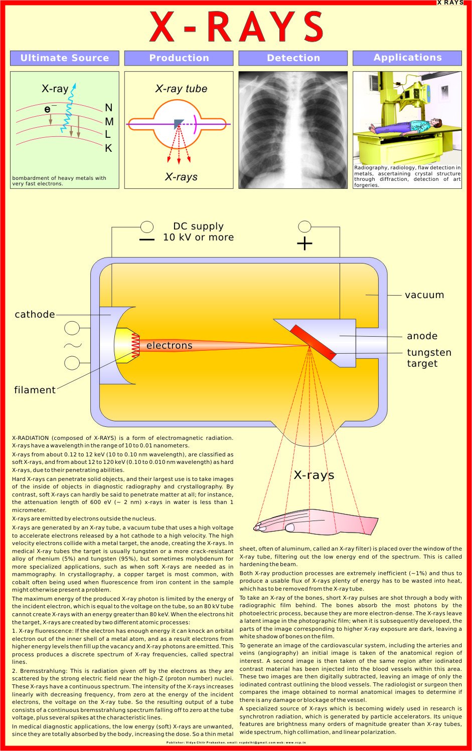 XRays Chart | Laminated | 55 x 90 cm | Physics Chart | Science Chart