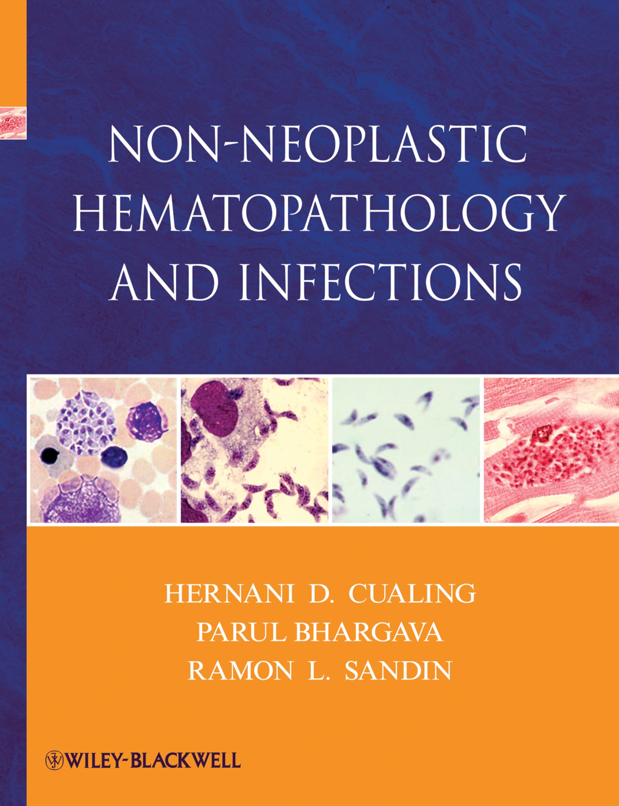 NonNeoplastic Hematopathology and Infections