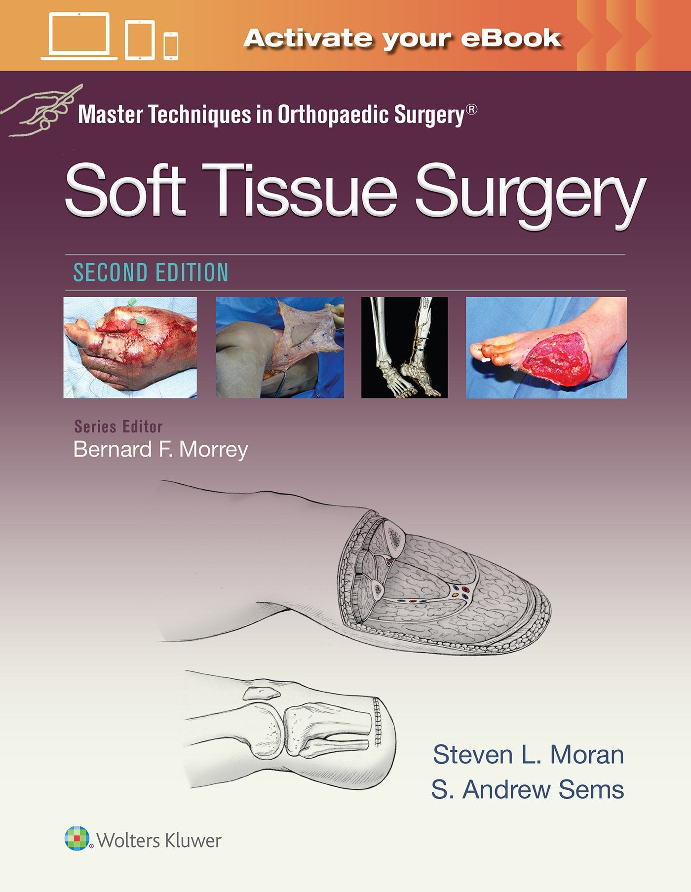 Master Techniques In Orthopaedic Surgery Soft Tissue Surgery 2Ed (Hb 2017)