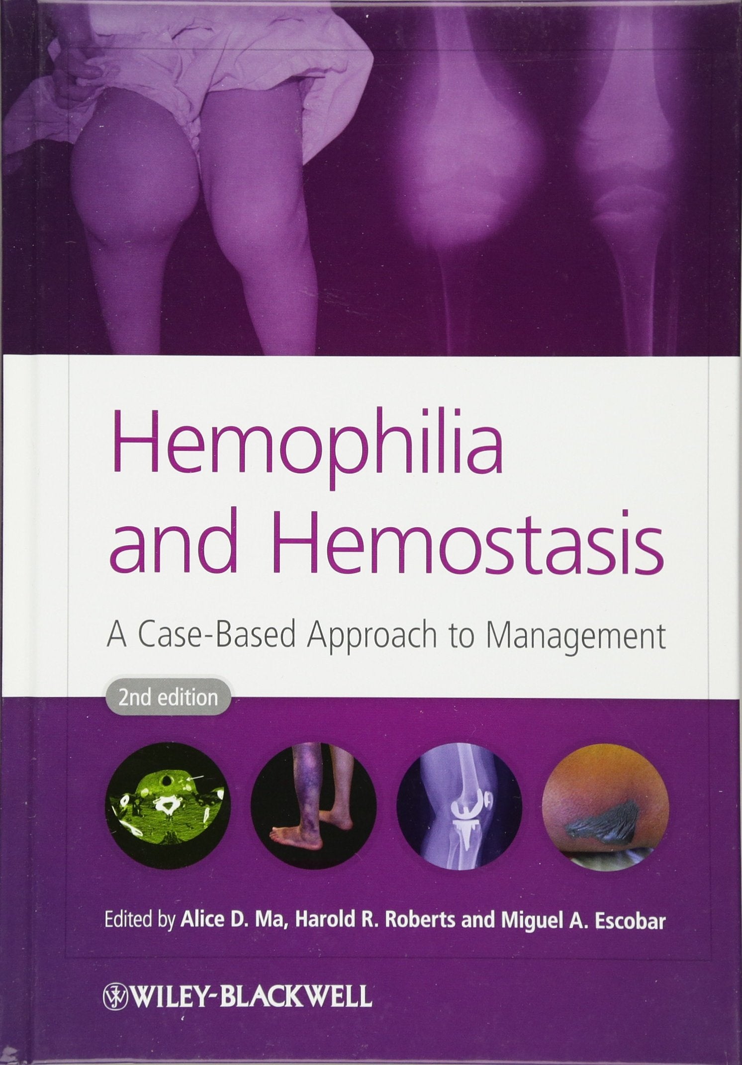 Hemophilia and Hemostasis: A CaseBased Approach to Management