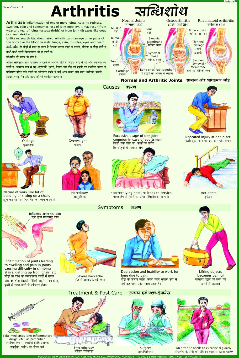 Arthritis Chart