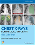 Chest XRays for Medical Students: CXRs Made Easy